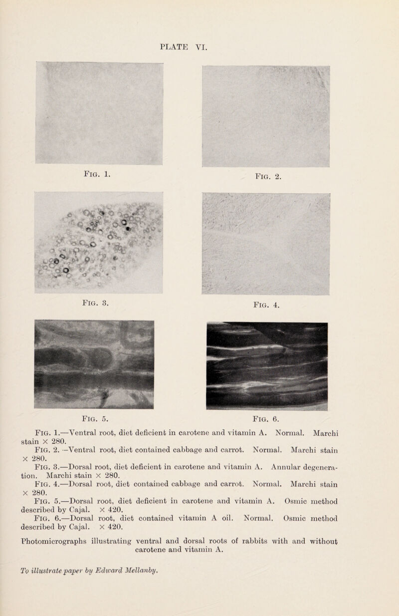 Fig. 1. Fig. 2. Fig. 5. Fig. 6. Fig. 1.—Ventral root, diet deficient in carotene and vitamin A. Normal. Marchi stain X 280. Fig. 2. -Ventral root, diet contained cabbage and carrot. Normal. Marchi stain X 280. Fig. 8.—Dorsal root, diet deficient in carotene and vitamin A. Annular degenera¬ tion. Marchi stain X 280. Fig. 4.—Dorsal root, diet contained cabbage and carrot. Normal. Marchi stain X 280. Fig. 5.—Dorsal root, diet deficient in carotene and vitamin A. Osmic method described by Cajal. X 420. Fig. 6.—Dorsal root, diet contained vitamin A oil. Normal. Osmic method described by Cajal. X 420. Photomicrographs illustrating ventral and dorsal roots of rabbits with and without carotene and vitamin A.
