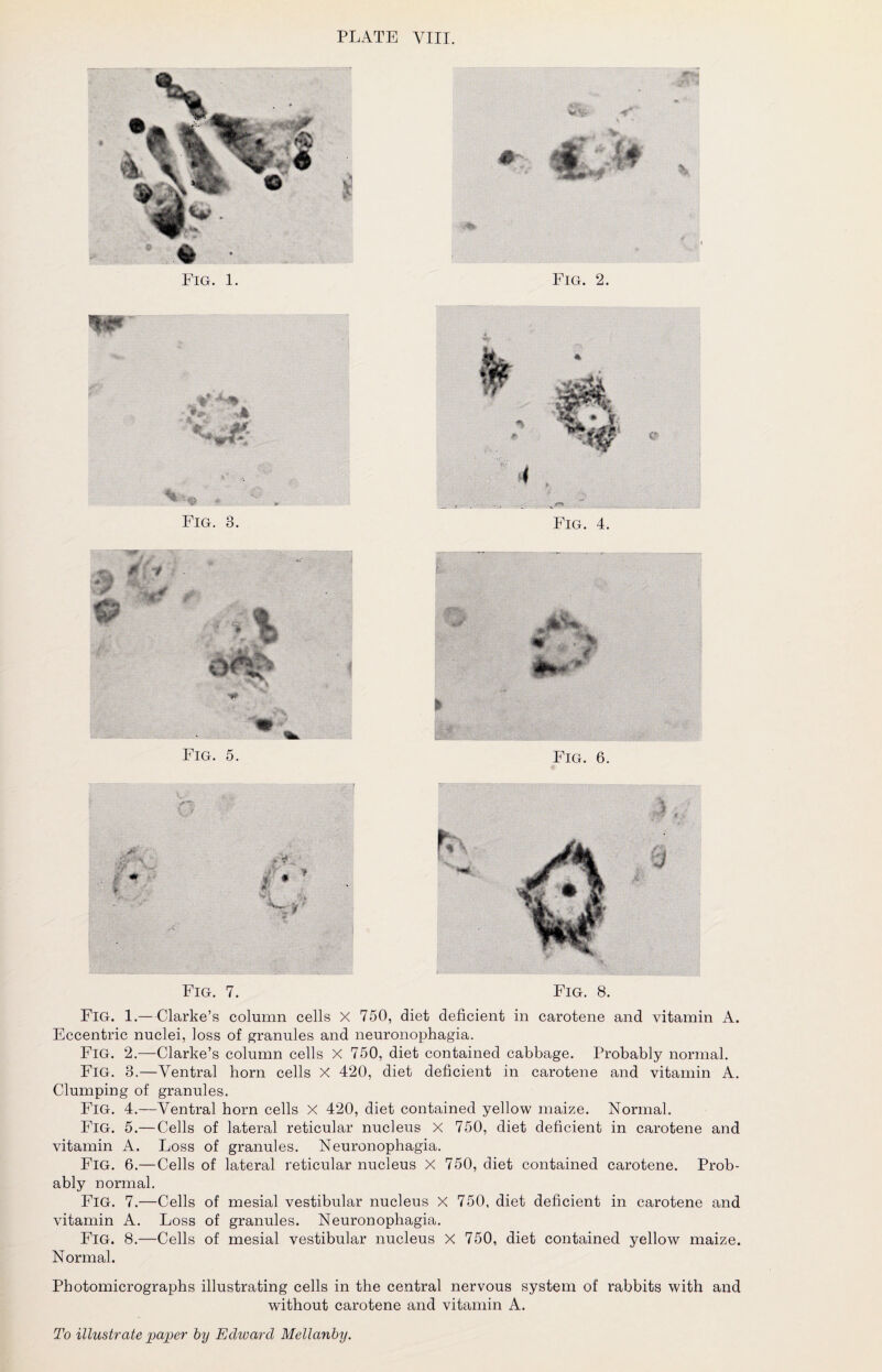Fig. 1. Fig. 2. Fig. 3. Fig. 4. Fig. 5. ••**** . I- S’ - * I Fig. 6. Fig. 1.—-Clarke’s column cells X 750, diet deficient in carotene and vitamin A. Eccentric nuclei, loss of granules and neuronophagia. Fig. 2.—Clarke’s column cells X 750, diet contained cabbage. Probably normal. Fig. 3.—Ventral horn cells X 420, diet deficient in carotene and vitamin A. Clumping of granules. Fig. 4.—Ventral horn cells X 420, diet contained yellow maize. Normal. Fig. 5.— Cells of lateral reticular nucleus X 750, diet deficient in carotene and vitamin A. Loss of granules. Neuronophagia. Fig. 6.—Cells of lateral reticular nucleus X 750, diet contained carotene. Prob¬ ably normal. Fig. 7.—Cells of mesial vestibular nucleus X 750, diet deficient in carotene and vitamin A. Loss of granules. Neuronophagia. Fig. 8.—Cells of mesial vestibular nucleus X 750, diet contained yellow maize. Normal. Photomicrographs illustrating cells in the central nervous system of rabbits with and without carotene and vitamin A.