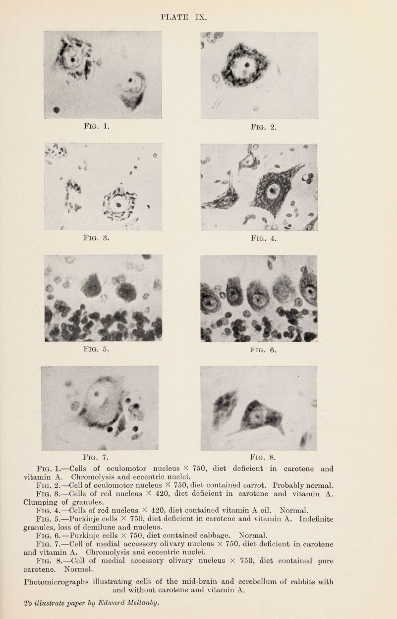 Fig. 2. Fig. 1. Fig. 3. Fig. 4. Fig. 6. Fig. 5. Fig. 1.—Cells of oculomotor nucleus X 750, diet deficient in carotene and vitamin A. Chromolysis and eccentric nuclei. Fig. 2.—Cell of oculomotor nucleus X 750, diet contained carrot. Probably normal. Fig. 3.—Cells of red nucleus X 420, diet deficient in carotene and vitamin A. Clumping of granules. Fig. 4.—Cells of red nucleus X 420, diet contained vitamin A oil. Normal. Fig. 5.—Purkinje cells X 750, diet deficient in carotene and vitamin A. Indefinite granules, loss of demilune and nucleus. Fig. 6.—Purkinje cells X 750, diet contained cabbage. Normal. Fig. 7.—Cell of medial accessory olivary nucleus X 750, diet deficient in carotene and vitamin A. Chromolysis and eccentric nuclei. Fig. 8.—Cell of medial accessory olivary nucleus X 750, diet contained pure carotene. Normal. Photomicrographs illustrating cells of the mid-brain and cerebellum of rabbits with and without carotene and vitamin A.