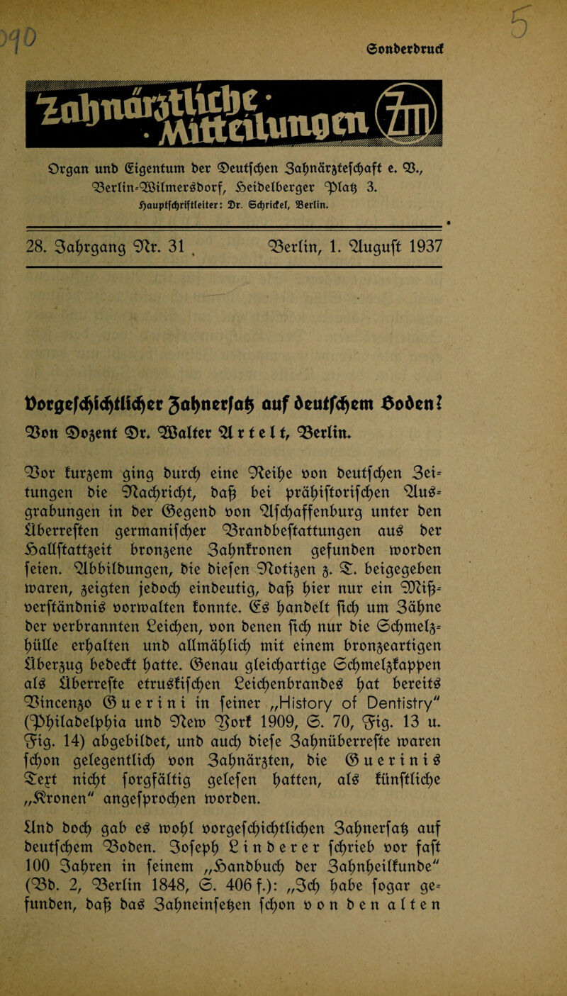 ©ottberbnnf J*-S&M« Organ unb Eigentum ber ©eutfcfjen Sctfmärätefdjaff e. 93», Q3ertin--c3ßümer^borf/ ioeibetberger 3. i)auptfd)rtftletter: 2)r. 6d)ricfel, SSerlin. , • 28» 3ahrgang 3lr. 31 ( 93erlin, 1» <2luguft 1937 üotgef^f^tli^et auf deutfäjeut 6oötnl 93on 0bsent 0r. haltet 91 11 e l f, 93erlin. 93or fur^em ging burcf) eine 99eihe non beutfcf)en 3ei= tungen bie ÜZachrichf, baf? bet prähiftorifcf)en 9lu3= grabungen in ber ©egenb non 91fcf)affenburg unter ben Überreffen germanifcf)er 93ranbbeffaftungen au£ ber Äadftatfseit bronzene Salmfronen gefunben tnorben feien» 9ibbilbungen, bie biefen Zotigen 3» £. beigegeben toaren, geigten jeboch einbeufig, baf? f>ier nur ein 9D9ih-- nerffänbni£ nortnalfen fonnfe» (£$ f)anbelf ftd) unt 3äl)ne ber nerbrannfen Seichen, non benen fiel) nur bie 6cf)tnel3= hülle erhalten unb allmählich mit einem bron^earfigen Überzug bebeeft 1)atte. ©enau gleichartige ©chmel^fappen alg Überreffe etru3fifcf)en Seicf)enbranbe£ Im* bereite 93ütcen§o ©uerini in feiner „History of Dentistry (^^itabelp^ia unb 99eto TJorf 1909, 6» 70, $4g. 13 u» 34g. 14) abgebilbef, unb auch biefe Safmüberreffe maren fcf)on gelegentlich non 3ahnär§ten, bie © u e r i n i $ £e£f nicht forgfältig gelefen haffen, al3 fünftlicf)e „fronen angebrochen tnorben. ünb hoch gab eg tnohl norgefchichtlichen 3ahnerfah auf beutfdtem 93oben. 3ofeph Sin ber er fd>rieb nor faff 100 3ahren in feinem „Äanbbuch ber Sahnheüfunbe (93b. 2, 93erlin 1848, 6. 406 f.): „3cf) fmüe fegar ge= funben, bah 3ahneinfehen fcf)on non ben alten