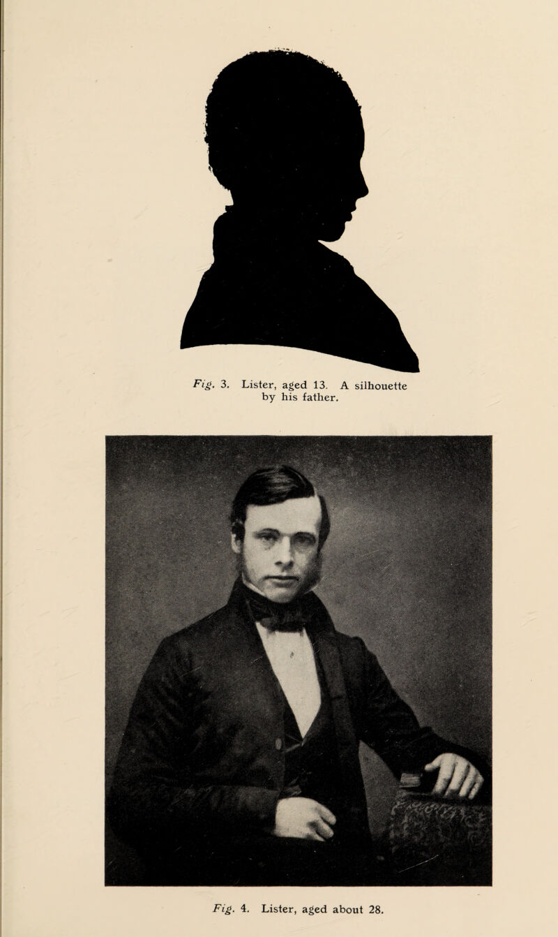 Fig. 3. Lister, aged 13. A silhouette by his father.