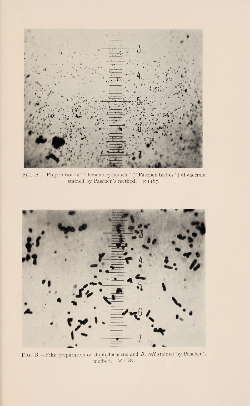 ' h Fig. A.—Preparation of “ elementary bodies ” (“ Paschen bodies ”) of vaccinia stained by Paschen’s method. X 1187. Fig. B.— Film preparation of staphylococcus and B. colt stained by Paschen’s method. X1187.