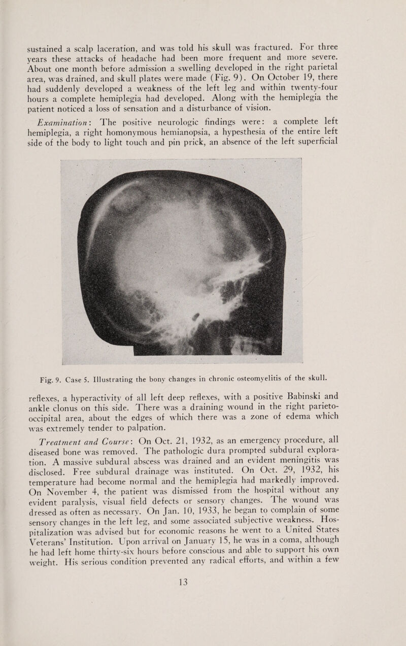 sustained a scalp laceration, and was told his skull was fractured, for three years these attacks of headache had been more frequent and more severe. About one month before admission a swelling developed in the right parietal area, was drained, and skull plates were made (Fig. 9). On October 19, there had suddenly developed a weakness of the left leg and within twenty-four hours a complete hemiplegia had developed. Along with the hemiplegia the patient noticed a loss of sensation and a disturbance of vision. Examination'. The positive neurologic findings were: a complete left hemiplegia, a right homonymous hemianopsia, a hypesthesia of the entire left side of the body to light touch and pin prick, an absence of the left superficial Fig. 9. Case 5. Illustrating the bony changes in chronic osteomyelitis of the skull. reflexes, a hyperactivity of all left deep reflexes, with a positive Babinski and ankle clonus on this side. There was a draining wound in the right parieto¬ occipital area, about the edges of which there was a zone of edema which was extremely tender to palpation. Treatment and Course: On Oct. 21, 1932, as an emergency procedure, all diseased bone was removed. The pathologic dura prompted subdural explora¬ tion. A massive subdural abscess was drained and an evident meningitis was disclosed. Free subdural drainage was instituted. On Oct. z9, 1932, his temperature had become normal and the hemiplegia had markedly improved. On November 4, the patient was dismissed from the hospital without any evident paralysis, visual field defects or sensory changes. I he wound was dressed as often as necessary. On Jan. 10, 1933, he began to complain of some sensory changes in the left leg, and some associated subjective weakness. Hos pitalization was advised but for economic reasons he went to a United States Veterans’ Institution. Upon arrival on January 15, he was in a coma, although he had left home thirty-six hours before conscious and able to support his own weight. His serious condition prevented any radical efforts, and within a few