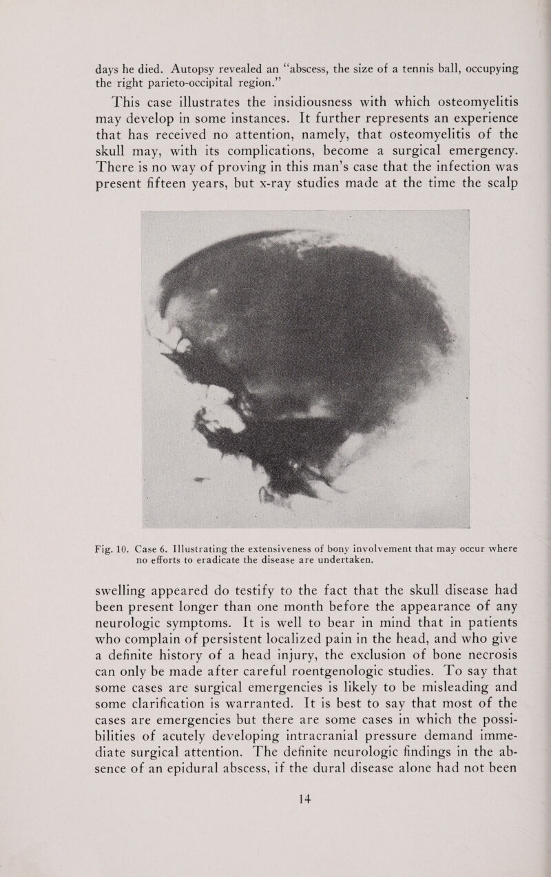 days he died. Autopsy revealed an “abscess, the size of a tennis ball, occupying the right parieto-occipital region.” This case illustrates the insidiousness with which osteomyelitis may develop in some instances. It further represents an experience that has received no attention, namely, that osteomyelitis of the skull may, with its complications, become a surgical emergency. There is no way of proving in this man’s case that the infection was present fifteen years, but x-ray studies made at the time the scalp Fig. 10. Case 6. Illustrating the extensiveness of bony involvement that may occur where no efforts to eradicate the disease are undertaken. swelling appeared do testify to the fact that the skull disease had been present longer than one month before the appearance of any neurologic symptoms. It is well to bear in mind that in patients who complain of persistent localized pain in the head, and who give a definite history of a head injury, the exclusion of bone necrosis can only be made after careful roentgenologic studies. To say that some cases are surgical emergencies is likely to be misleading and some clarification is warranted. It is best to say that most of the cases are emergencies but there are some cases in which the possi¬ bilities of acutely developing intracranial pressure demand imme¬ diate surgical attention. The definite neurologic findings in the ab¬ sence of an epidural abscess, if the dural disease alone had not been