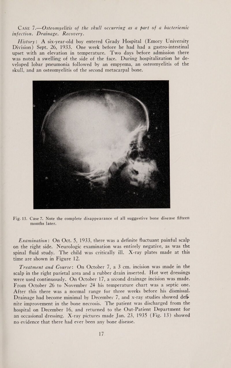 Case 7.—Osteomyelitis of the skull occurring as a part of a hacteriemic infection. Drainage. Recovery. History: A six-year-old boy entered Grady Hospital (Emory University Division) Sept. 26, 1933. One week before he had had a gastro-intestinal upset with an elevation in temperature. Two days before admission there was noted a swelling of the side of the face. During hospitalization he de¬ veloped lobar pneumonia followed by an empyema, an osteomyelitis of the skull, and an osteomyelitis of the second metacarpal bone. Fig. 13. Case 7. Note the complete disappearance of all suggestive bone disease fifteen months later. Examination: On Oct. 5, 1933, there was a definite fluctuant painful scalp on the right side. Neurologic examination was entirely negative, as was the spinal fluid study. The child was critically ill. X-ray plates made at this time are shown in Figure 12. Treatment and Course: On October 7, a 3 cm. incision was made in the scalp in the right parietal area and a rubber drain inserted. Hot wet dressings were used continuously. On October 17, a second drainage incision was made. From October 26 to November 24 his temperature chart was a septic one. After this there was a normal range for three weeks before his dismissal- Drainage had become minimal by December 7, and x-ray studies showed defr nite improvement in the bone necrosis. The patient was discharged from the hospital on December 16, and returned to the Out-Patient Department for an occasional dressing. X-ray pictures made Jan. 23, 1935 (Fig. 13) showed no evidence that there had ever been any bone disease.