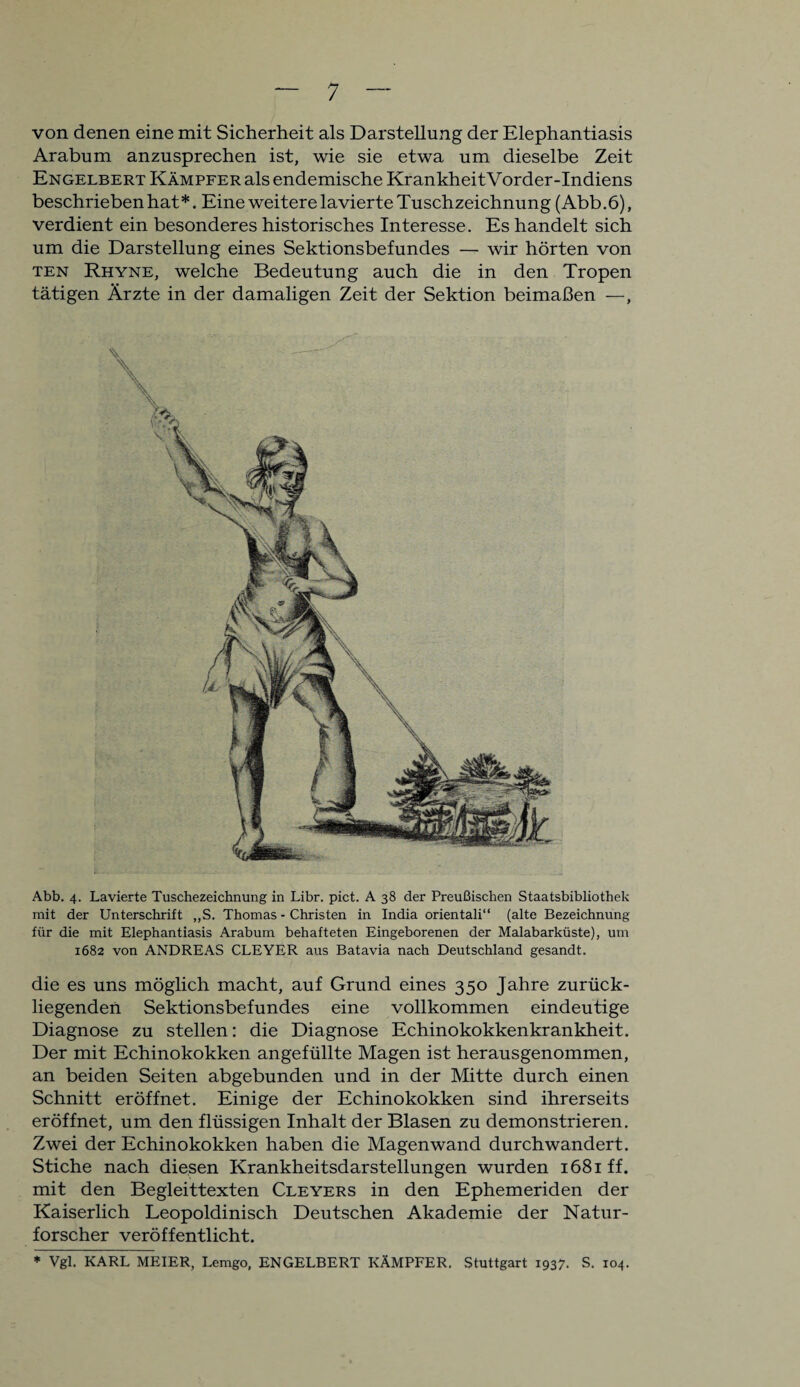 von denen eine mit Sicherheit als Darstellung der Elephantiasis Arabum anzusprechen ist, wie sie etwa um dieselbe Zeit Engelbert Kämpfer als endemische KrankheitVorder-Indiens beschrieben hat *. Eine weitere lavierte Tuschzeichnung (Abb. 6), verdient ein besonderes historisches Interesse. Es handelt sich um die Darstellung eines Sektionsbefundes — wir hörten von ten Rhyne, welche Bedeutung auch die in den Tropen tätigen Ärzte in der damaligen Zeit der Sektion beimaßen —, Abb. 4. Lavierte Tuschezeichnung in Libr. pict. A 38 der Preußischen Staatsbibliothek mit der Unterschrift ,,S. Thomas - Christen in India orientali“ (alte Bezeichnung für die mit Elephantiasis Arabum behafteten Eingeborenen der Malabarküste), um 1682 von ANDREAS CLEYER aus Batavia nach Deutschland gesandt. die es uns möglich macht, auf Grund eines 350 Jahre zurück¬ liegenden Sektionsbefundes eine vollkommen eindeutige Diagnose zu stellen: die Diagnose Echinokokkenkrankheit. Der mit Echinokokken angefüllte Magen ist herausgenommen, an beiden Seiten abgebunden und in der Mitte durch einen Schnitt eröffnet. Einige der Echinokokken sind ihrerseits eröffnet, um den flüssigen Inhalt der Blasen zu demonstrieren. Zwei der Echinokokken haben die Magenwand durchwandert. Stiche nach diesen Krankheitsdarstellungen wurden 1681 ff. mit den Begleittexten Cleyers in den Ephemeriden der Kaiserlich Leopoldinisch Deutschen Akademie der Natur¬ forscher veröffentlicht. * Vgl. KARL MEIER, Lemgo, ENGELBERT KÄMPFER. Stuttgart 1937. S. 104.