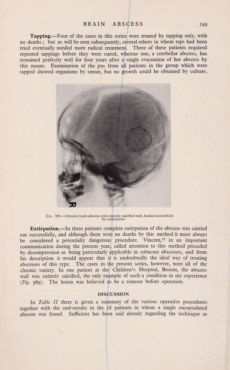 Tapping.—Four of the cases in this series were treated by tapping only, with no deaths ; but as will be seen subsequently, several others in whom taps had been tried eventually needed more radical treatment. Three of these patients required repeated tappings before they were cured, whereas one, a cerebellar abscess, has remained perfectly well for four years after a single evacuation of her abscess by this means. Examination of the pus from all patients in the group which were tapped showed organisms by smear, but no growth could be obtained by culture. Fig. 389.—Chronic brain abscess with entirely calcified wall3 healed successfully by extirpation. Extirpation.—In three patients complete extirpation of the abscess was carried out successfully, and although there were no deaths by this method it must always be considered a potentially dangerous procedure. Vincent,12 in an important communication during the present year, called attention to this method preceded by decompression as being particularly applicable in subacute abscesses, and from his description it would appear that it is undoubtedly the ideal way of treating abscesses of this type. The cases in the present series, however, were all of the chronic variety. In one patient at the Children’s Hospital, Boston, the abscess wall was entirely calcified, the only example of such a condition in my experience {Fig. 389). The lesion was believed to be a tumour before operation. DISCUSSION In Table II there is given a summary of the various operative procedures together with the end-results in the 18 patients in whom a single encapsulated abscess was found. Sufficient has been said already regarding the technique as