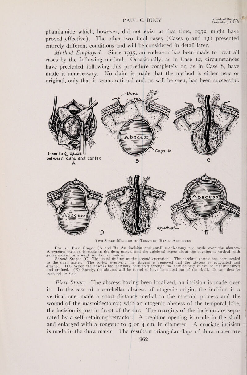 p December, 1 9 il S phanilamide which, however, did not exist at that time, 1932, might have proved ef¥ective). The other two fatal cases (Cases 9 and 13) presented entirely different conditions and will be considered in detail later. Method Employed.—Since 1935, an endeavor has been made to treat all cases by the following method. Occasionally, as in Case 12, circumstances have precluded following this procedure completely or, as in Case 8, have made it unnecessary. No claim is made that the method is either new or original, only that it seems rational and, as will be seen, has been successful. Tvvo-Stage Method of Treating Brain Abscesses Fig. I.—First Stage: (A and B) An incision and small craniectomy are made over the abscess. A cruciate incision is made in the dura mater, and the subdural space about the opening is packed with gauze soaked in a weak solution of iodine. Second Stage: (C) The usual finding at the second operation. The cerebral cortex has been sealed to the dura mater. The cortex overlying the abscess is removed and the abscess is evacuated and drained. (D) When the abscess has partially herniated through the craniectomy it can be marsupialized and drained. (E) Rarely, the abscess will be found to have herniated out of the skull. It can then be removed in toto. First Stage.—The abscess having been localized, an incision is made over it. In the case of a cerebellar aliscess of otogenic origin, the incision is a vertical one, made a short distance medial to the mastoid process and the wound of the mastoidectomy; with an otogenic abscess of the temporal lobe, ? the incision is just in front of the ear. The margins of the incision are sepa- * rated by a self-retaining ‘retractor. A trephine opening is made in the skull ’ and enlarged with a rongeur to 3 or 4 cm. in diameter. A cruciate incision is made in the dura mater. The resultant triangular flaps of dura mater are ,