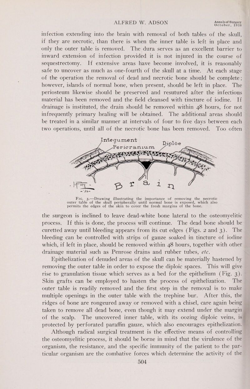 October, 1938 infection extending into the brain with removal of both tables of the skull, if they are necrotic, than there is when the inner table is left in place and only the outer table is removed. The dura serves as an excellent barrier to inward extension of infection provided it is not injured in the course of sequestrectomy. If extensive areas have become involved, it is reasonably safe to uncover as much as one-fourth of the skull at a time. At each stage of the operation the removal of dead and necrotic bone should be complete; however, islands of normal bone, when present, should be left in place. The periosteum likewise should be preserved and resutured after the infectious material has been removed and the field cleansed with tincture of iodine. If drainage is instituted, the drain should be removed within 48 hours, for not infrequently primary healing will be obtained. The additional areas should be treated in a similar manner at intervals of four to five days between each two operations, until all of the necrotic bone has been removed. Too often Fig. 3.—Drawing illustrating the importance of removing the necrotic outer table of the skull peripherally until normal bone is exposed, which also permits the edges of the skin to cover the fresh margins of the bone. the surgeon is inclined to leave dead-white bone lateral to the osteomyelitic process. If this is done, the process will continue. The dead bone should be curetted away until bleeding appears from its cut edges (Figs. 2 and 3). The bleeding can be controlled with strips of gauze soaked in tincture of iodine which, if left in place, should be removed within 48 hours, together with other drainage material such as Penrose drains and rubber tubes, etc. Epithelization of denuded areas of the skull can be materially hastened by removing the outer table in order to expose the diploic spaces. This will give rise to granulation tissue which serves as a bed for the epithelium (Fig. 3). Skin grafts can be employed to hasten the process of epithelization. The outer table is readily removed and the first step in the removal is to make multiple openings in the outer table with the trephine bur. After this, the ridges of bone are rongeured away or removed with a chisel, care again being taken to remove all dead bone, even though it may extend under the margin of the scalp. The uncovered inner table, with its oozing diploic veins, is protected by perforated paraffin gauze, which also encourages epithelization. Although radical surgical treatment is the effective means of controlling the osteomyelitic process, it should be borne in mind that the virulence of the organism, the resistance, and the specific immunity of the patient to the par¬ ticular organism are the combative forces which determine the activity of the