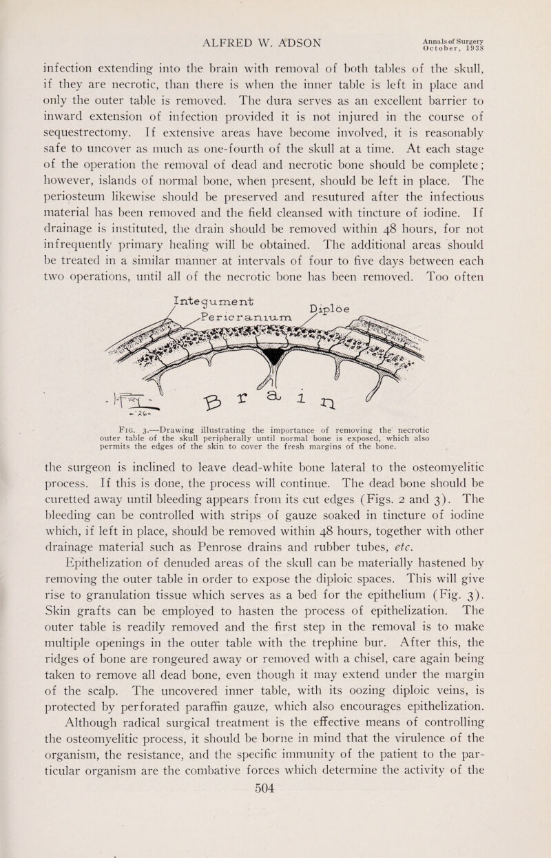 October, 1938 infection extending into the brain with removal of both tables of the skull, if they are necrotic, than there is when the inner table is left in place and only the outer table is removed. The dura serves as an excellent barrier to inward extension of infection provided it is not injured in the course of sequestrectomy. If extensive areas have become involved, it is reasonably safe to uncover as much as one-fourth of the skull at a time. At each stage of the operation the removal of dead and necrotic bone should be complete; however, islands of normal bone, when present, should be left in place. The periosteum likewise should be preserved and resuturecl after the infectious material has been removed and the field cleansed with tincture of iodine. If drainage is instituted, the drain should be removed within 48 hours, for not infrequently primary healing will be obtained. The additional areas should be treated in a similar manner at intervals of four to five days between each two operations, until all of the necrotic bone has been removed. Too often Fig. 3.—Drawing illustrating the importance of removing the necrotic outer table of the skull peripherally until normal bone is exposed, which also permits the edges of the skin to cover the fresh margins of the bone. the surgeon is inclined to leave dead-white bone lateral to the osteomyelitic process. If this is done, the process will continue. The dead bone should be curetted away until bleeding appears from its cut edges (Figs. 2 and 3). The bleeding can be controlled with strips of gauze soaked in tincture of iodine which, if left in place, should be removed within 48 hours, together with other drainage material such as Penrose drains and rubber tubes, etc. Epithelization of denuded areas of the skull can be materially hastened by removing the outer table in order to expose the diploic spaces. This will give rise to granulation tissue which serves as a bed for the epithelium (Fig. 3). Skin grafts can be employed to hasten the process of epithelization. The outer table is readily removed and the first step in the removal is to make multiple openings in the outer table with the trephine bur. After this, the ridges of bone are rongeured away or removed with a chisel, care again being taken to remove all dead bone, even though it may extend under the margin of the scalp. The uncovered inner table, with its oozing diploic veins, is protected by perforated paraffin gauze, which also encourages epithelization. Although radical surgical treatment is the effective means of controlling the osteomyelitic process, it should be borne in mind that the virulence of the organism, the resistance, and the specific immunity of the patient to the par¬ ticular organism are the combative forces which determine the activity of the