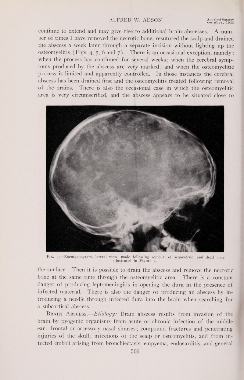 October, 1938 continue to extend and may give rise to additional brain abscesses. A num¬ ber of times I have removed the necrotic bone, resutured the scalp and drained the abscess a week later through a separate incision without lighting up the osteomyelitis (Figs. 4, 5, 6 and 7). There is an occasional exception, namely: when the process has continued for several weeks; when the cerebral symp¬ toms produced by the abscess are very marked; and when the osteomyelitic process is limited and apparently controlled. In those instances the cerebral abscess has been drained first and the osteomyelitis treated following removal of the drains. There is also the occasional case in which the osteomyelitic area is very circumscribed, and the abscess appears to be situated close to Fig. 5.—Roentgenogram, lateral view, made following removal of sequestrum and dead bone illustrated in Figure 4. the surface. Then it is possible to drain the abscess and remove the necrotic bone at the same time through the osteomyelitic area. There is a constant danger of producing leptomeningitis in opening the dura in the presence of infected material. There is also the danger of producing an abscess by in¬ troducing a needle through infected dura into the brain when searching for a subcortical abscess. Brain Abscess.—Etiology: Brain abscess results from invasion of the brain by pyogenic organisms from acute or chronic infection of the middle ear; frontal or accessory nasal sinuses; compound fractures and penetrating injuries of the skull; infections of the scalp or osteomyelitis, and from in¬ fected emboli arising from bronchiectasis, empyema, endocarditis, and general