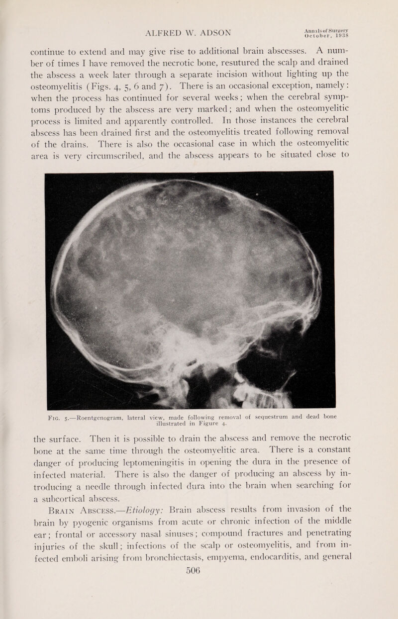 October, 1938 continue to extend and may give rise to additional brain abscesses. A num¬ ber of times I have removed the necrotic bone, resutured the scalp and drained the abscess a week later through a separate incision without lighting up the osteomyelitis (Figs. 4, 5, 6 and 7). There is an occasional exception, namely: when the process has continued for several weeks; when the cerebral symp¬ toms produced by the abscess are very marked; and when the osteomyelitic process is limited and apparently controlled. In those instances the cerebral abscess has been drained first and the osteomyelitis treated following removal of the drains. There is also the occasional case in which the osteomyelitic area is very circumscribed, and the abscess appears to be situated close to Fig. 5.—Roentgenogram, lateral view, made following removal of sequestrum and dead bone illustrated in Figure 4. the surface. Then it is possible to drain the abscess and remove the necrotic bone at the same time through the osteomyelitic area. There is a constant danger of producing leptomeningitis in opening the dura in the presence of infected material. There is also the danger of producing an abscess by in¬ troducing a needle through infected dura into the brain when searching for a subcortical abscess. Brain Abscess.—Etiology: Brain abscess results from invasion of the brain by pyogenic organisms from acute or chronic infection of the middle ear; frontal or accessory nasal sinuses; compound fractures and penetrating injuries of the skull; infections of the scalp or osteomyelitis, and from in¬ fected emboli arising from bronchiectasis, empyema, endocarditis, and general