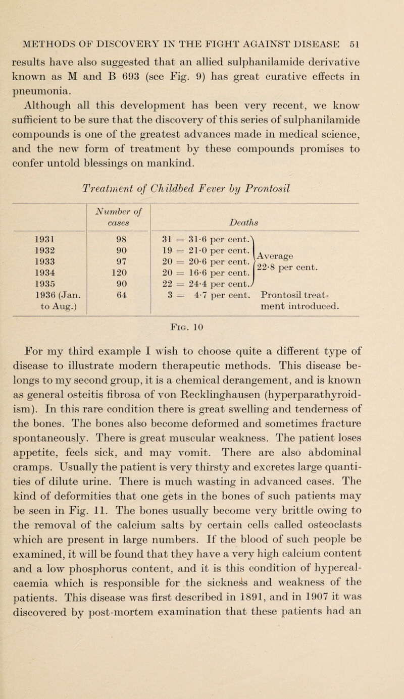 results have also suggested that an allied sulphanilamide derivative known as M and B 693 (see Fig. 9) has great curative effects in pneumonia. Although all this development has been very recent, we know sufficient to be sure that the discovery of this series of sulphanilamide compounds is one of the greatest advances made in medical science, and the new form of treatment by these compounds promises to confer untold blessings on mankind. Treatment of Childbed Fever by Prontosil Number of cases 1931 98 1932 90 1933 97 1934 120 1935 90 1936(Jan. 64 to Aug.) Deaths 31 = 31*6 per cent. 19 = 21-0 per cent. 20 = 20-6 per cent. 20 = 16-6 per cent. 22 = 24-4 per cent.) 3 = 4*7 per cent. Prontosil treat¬ ment introduced. Average 22-8 per cent. Fig. 10 For my third example I wish to choose quite a different type of disease to illustrate modern therapeutic methods. This disease be¬ longs to my second group, it is a chemical derangement, and is known as general osteitis fibrosa of von Recklinghausen (hyperparathyroid¬ ism). In this rare condition there is great swelling and tenderness of the bones. The bones also become deformed and sometimes fracture spontaneously. There is great muscular weakness. The patient loses appetite, feels sick, and may vomit. There are also abdominal cramps. Usually the patient is very thirsty and excretes large quanti¬ ties of dilute urine. There is much wasting in advanced cases. The kind of deformities that one gets in the bones of such patients may be seen in Fig. 11. The bones usually become very brittle owing to the removal of the calcium salts by certain cells called osteoclasts which are present in large numbers. If the blood of such people be examined, it will be found that they have a very high calcium content and a low phosphorus content, and it is this condition of hypercal- caemia which is responsible for the sickness and weakness of the patients. This disease was first described in 1891, and in 1907 it was discovered by post-mortem examination that these patients had an