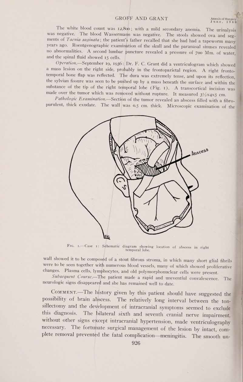 June, 1940 The white blood count was 12,800; with a mild secondary anemia. The urinalysis was negative. The blood Wassermann was negative. The stools showed ova and seg¬ ments of Taenia saginata; the patient’s father recalled that she had had a tapeworm many years ago. Roentgenographic examination of the skull and the paranasal sinuses revealed no abnormalities. A second lumbar puncture revealed a pressure of 700 Mm. of water, and the spinal fluid showed 15 cells. Operation. September 19, 1936: Dr. F. C. Grant did a ventriculogram which showed a mass lesion on the right side, probably in the frontoparietal region. A right fronto¬ temporal bone flap was reflected. The dura was extremely tense, and upon its reflection, the sylvian fissure was seen to be pushed up by a mass beneath the surface and within the substance of the tip of the right temporal lobe (Fig. 1). A transcortical incision was made ovei the tumor which was removed without rupture. It measured 372x4x5 cm Pathologic Examination. Section of the tumor revealed an abscess filled with a fibro- purulent, thick exudate. The wall was 0.5 cm. thick. Microscopic examination of the wall showed it to be composed of a stout fibrous stroma, in which many short glial fibrils were to be seen together with numerous blood vessels, many of which showed proliferative changes. Plasma cells, lymphocytes, and old polymorphonuclear cells were present. Subsequent Course.—The patient made a rapid and uneventful convalescence. The neurologic signs disappeared and she has remained well to date. Comment.—The history given by this patient should have suggested the possibility of brain abscess. The relatively long interval between the ton¬ sillectomy and the development of intracranial symptoms seemed to exclude this diagnosis. The bilateral sixth and seventh cranial nerve impairment, without other signs except intracranial hypertension, made ventriculography necessary. I he foitunate suigical management of the lesion by intact, com¬ plete removal prevented the fatal complication—meningitis. The smooth un-