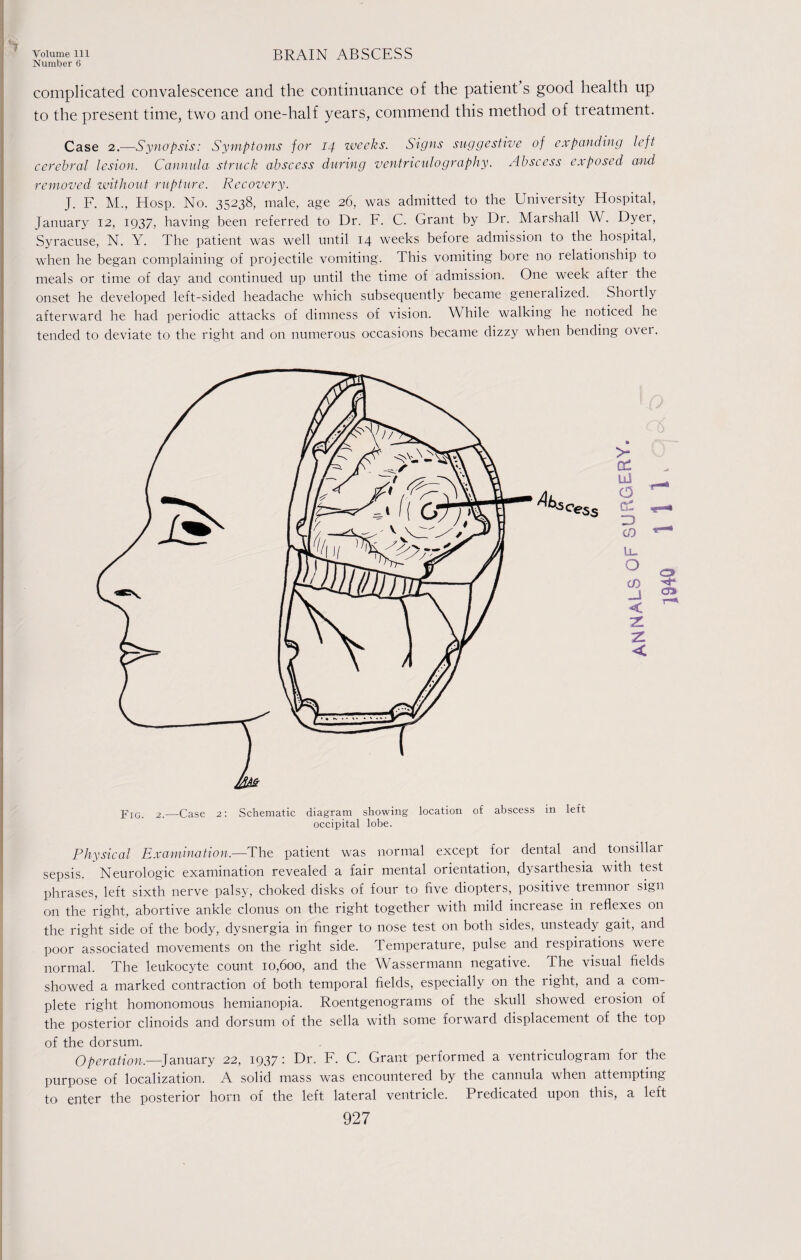 Number 6 A complicated convalescence and the continuance of the patient s good health up to the present time, two and one-half years, commend this method of treatment. Case 2.—Synopsis: Symptoms for 14 weeks. Signs suggestive of expanding left cerebral lesion. Cannula struck abscess during ventriculography. Abscess exposed and removed without rupture. Recovery. J. F. M., Hosp. No. 35238, male, age 26, was admitted to the University Hospital, January 12, 1937, having been referred to Dr. F. C. Grant by Dr. Marshall W. Dyer, Syracuse, N. Y. The patient was well until 14 weeks before admission to the hospital, when he began complaining of projectile vomiting. This vomiting bore no relationship to meals or time of day and continued up until the time of admission. One week after the onset he developed left-sided headache which subsequently became generalized. Shortly afterward he had periodic attacks of dimness of vision. While walking he noticed he tended to deviate to the right and on numerous occasions became dizzy when bending ovei. jrIG> 2.—Case 2: Schematic diagram showing location of abscess in left occipital lobe. Physical Examination,—The patient was normal except for dental and tonsillar sepsis. Neurologic examination revealed a fair mental orientation, dysarthesia with test phrases, left sixth nerve palsy, choked disks of four to five diopters, positive tremnor sign on the right, abortive ankle clonus on the right together with mild inciease in reflexes on the right side of the body, dysnergia in finger to nose test on both sides, unsteady gait, and poor associated movements on the right side. Temperature, pulse and respirations were normal. The leukocyte count 10,600, and the Wassermann negative. The visual fields showed a marked contraction of both temporal fields, especially on the right, and a com¬ plete right homonomous hemianopia. Roentgenograms of the skull showed erosion of the posterior clinoids and dorsum of the sella with some forward displacement of the top of the dorsum. Operation,—]anuary 22, 1937: Dr. F. C. Grant performed a ventriculogram for the purpose of localization. A solid mass was encountered by the cannula when attempting to enter the posterior horn of the left lateral ventricle. Predicated upon this, a left
