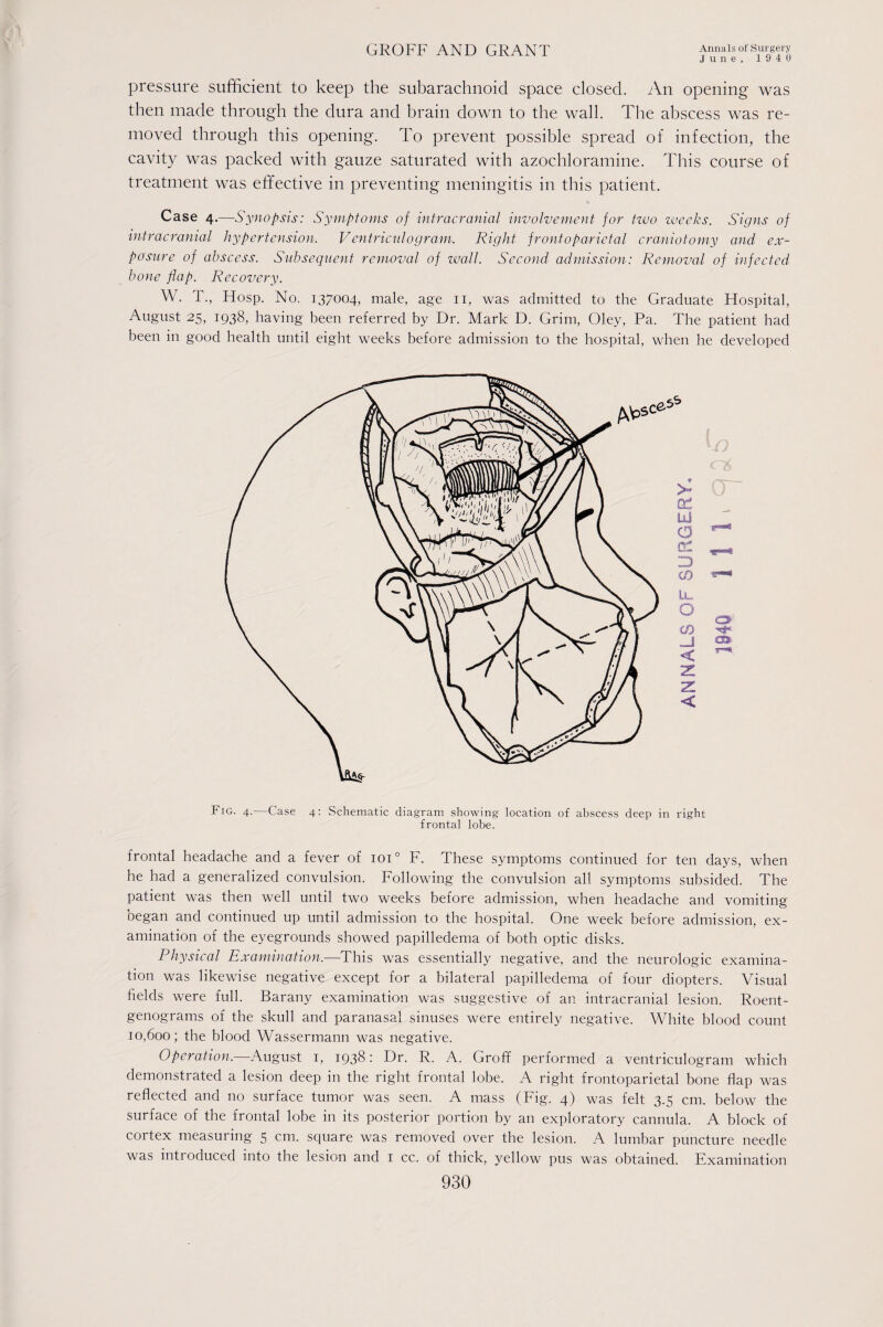 June, 1940 pressure sufficient to keep the subarachnoid space closed. An opening was then made through the dura and brain down to the wall. The abscess was re¬ moved through this opening. To prevent possible spread of infection, the cavity was packed with gauze saturated with azochloramine. This course of treatment was effective in preventing meningitis in this patient. Case 4.—Synopsis: Symptoms of intracranial involvement for two weeks. Signs of intracranial hypertension. Ventriculogram. Right frontoparietal craniotomy and ex¬ posure of abscess. Subsequent removal of wall. Second admission: Removal of infected bone flap. Recovery. W. T., Hosp. No. 137004, male, age 11, was admitted to the Graduate Hospital, August 25, 1938, having been referred by Dr. Mark D. Grim, Oley, Pa. The patient had been in good health until eight weeks before admission to the hospital, when he developed Fig. 4.—Case 4: Schematic diagram showing location of abscess deep in right frontal lobe. frontal headache and a fever of ioi° F. These symptoms continued for ten days, when he had a generalized convulsion. Following the convulsion all symptoms subsided. The patient was then well until two weeks before admission, when headache and vomiting began and continued up until admission to the hospital. One week before admission, ex¬ amination of the eyegrounds showed papilledema of both optic disks. Physical Examination.—This was essentially negative, and the neurologic examina¬ tion was likewise negative except for a bilateral papilledema of four diopters. Visual fields were full. Barany examination was suggestive of an intracranial lesion. Roent¬ genograms of the skull and paranasal sinuses were entirely negative. White blood count 10,600; the blood Wassermann was negative. Operation.—August 1, 1938: Dr. R. A. Groff performed a ventriculogram which demonstrated a lesion deep in the right frontal lobe. A right frontoparietal bone flap was reflected and no surface tumor was seen. A mass (Fig. 4) was felt 3.5 cm. below the surface of the frontal lobe in its posterior portion by an exploratory cannula. A block of cortex measuring 5 cm. square was removed over the lesion. A lumbar puncture needle was introduced into the lesion and 1 cc. of thick, yellow pus was obtained. Examination