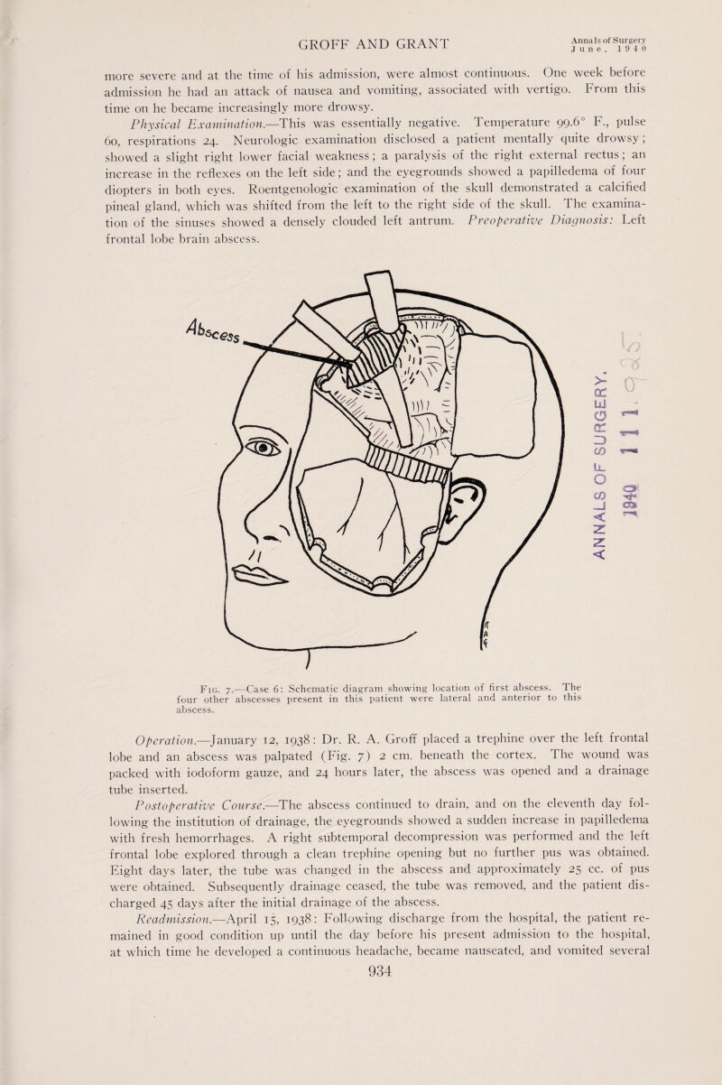 .June, 1940 more severe and at the time of his admission, were almost continuous. One week before admission he had an attack of nausea and vomiting, associated with vertigo. From this time on he became increasingly more drowsy. Physical Examination.—This was essentially negative. Temperature 99.6° F., pulse 60, respirations 24. Neurologic examination disclosed a patient mentally quite drowsy; showed a slight right lower facial weakness; a paralysis of the right external rectus; an increase in the reflexes on the left side; and the eyegrounds showed a papilledema of four diopters in both eyes. Roentgenologic examination of the skull demonstrated a calcified pineal gland, which was shifted from the left to the right side of the skull. The examina¬ tion of the sinuses showed a densely clouded left antrum. P re operative Diagnosis: Left frontal lobe brain abscess. Fig. 7.—Case 6: Schematic diagram showing location of first abscess. The four other abscesses present in this patient were lateral and anterior to this abscess. Operation.—January 12, 1938: Dr. R. A. Groff placed a trephine over the left frontal lobe and an abscess was palpated (Fig. 7) 2 cm. beneath the cortex. The wound was packed with iodoform gauze, and 24 hours later, the abscess was opened and a drainage tube inserted. Postoperative Course.—The abscess continued to drain, and on the eleventh day fol¬ lowing the institution of drainage, the eyegrounds showed a sudden increase in papilledema with fresh hemorrhages. A right subtemporal decompression was performed and the left frontal lobe explored through a clean trephine opening but no further pus was obtained. Eight days later, the tube was changed in the abscess and approximately 25 cc. of pus were obtained. Subsequently drainage ceased, the tube was removed, and the patient dis¬ charged 45 days after the initial drainage of the abscess. Readmission.—April 15, 1938: Following discharge from the hospital, the patient re¬ mained in good condition up until the day before his present admission to the hospital, at which time he developed a continuous headache, became nauseated, and vomited several