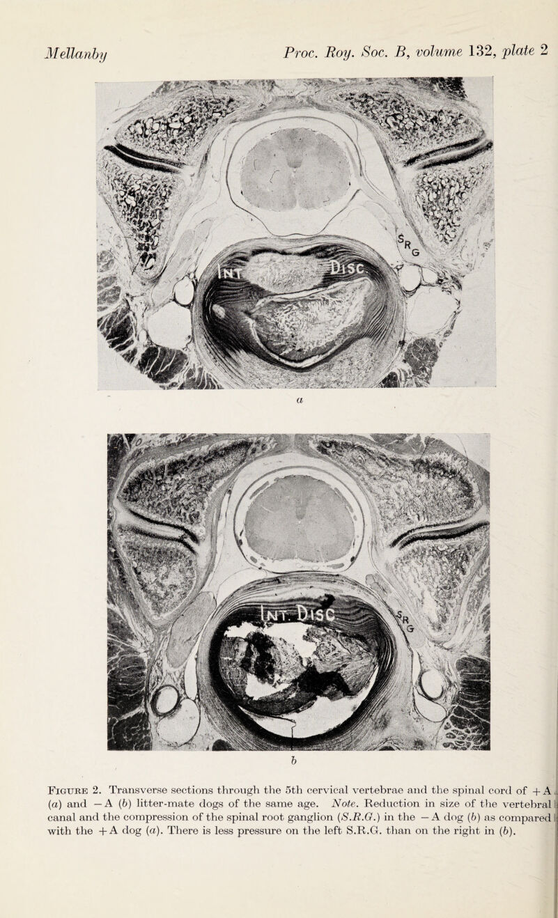 b Figure 2. Transverse sections through the 5th cervical vertebrae and the spinal cord of + A (a) and —A (6) litter-mate dogs of the same age. Note. Reduction in size of the vertebral canal and the compression of the spinal root ganglion (S.R.G.) in the — A dog (6) as compared with the +A dog (a). There is less pressure on the left S.R.G. than on the right in (6).