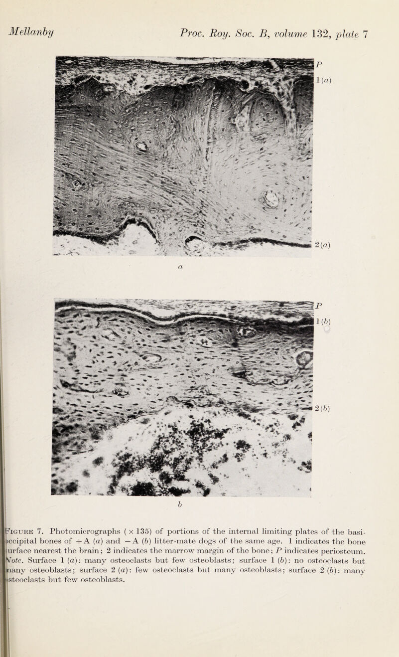 Figure 7. Photomicrographs ( x 135) of portions of the internal limiting plates of the basi- )ccipita.l bones of + A (a) and — A (6) litter-mate dogs of the same age. 1 indicates the bone urface nearest the brain; 2 indicates the marrow margin of the bone; P indicates periosteum. Tote. Surface 1 (a): many osteoclasts but few osteoblasts; surface 1 (6): no osteoclasts but lany osteoblasts; surface 2 (a): few osteoclasts but many osteoblasts; surface 2 (6): many »steoclasts but few osteoblasts.