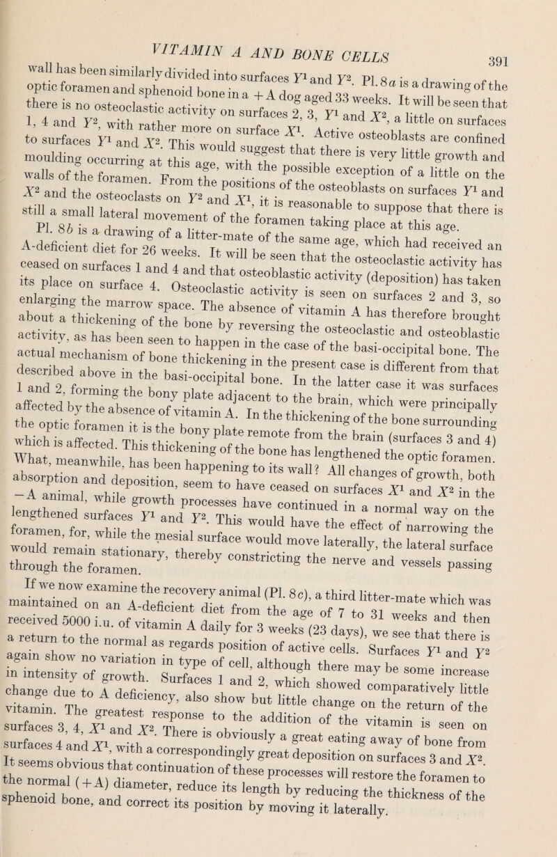 ^ of the there is no osteoclastic activity lITsurlcesI Tp LT5’ 1, 4 and with rather more on surfece ^ Acf f’m to surfaces Y^ and TIh’q ^ u t' osteoblasts are confined mouldmg occurlVat thi a .71* 8--*^ and walls of therramen Vro and the osteoclasts on7 and osteoblasts on surfaces yi and still a small lateral movement of tV, ’/ 4o suppose that there is A-deficient diet for 26 weeks Tr ,i k 7® ^®®«^®®' ceased on surflceri anil and ! T ^ m® **^® ®«*®°®l^«tic activity has its place on surface 4 Ostelf 1 1°^ (deposition) has taken enlarging the rnaLow snice it I   ®®® ^ -nd 3, so about aLckerntof ri ^''®/’^®®“®®.®fA has therefore brought activity, as has been seen to7 ®''®^''ig osteoclastic and osteoblastic actual n echan stof bone 117“  t ®® ®* **'® bone. The described abovet the L 1? 1 *^® P’’®®®^* fr®” that affected by the absence of vitntl^'rtt t*®'' '®'’® the optic foramen it is th e h,; thickenmg of the bone surrounding IS retSeS would rmnain stltionL7th '^ould move laterally, the lateral surface through the foramen ’ ^ constricting the nerve and vessels passing inTteS;;;:::r luSr; s f st s r ~ chance due to 7 fl • 1 ! “ showed comparatively little cnange due to A deficiency, also show but little change on the return of the vitamin. The greatest response to the addition of the .; '^be surfaces 3 4 Zi and T^^e • 1, • , ^ the vitamin is seen on surfaces 4 and Xi I tl ' obviously a great eating away of bone from