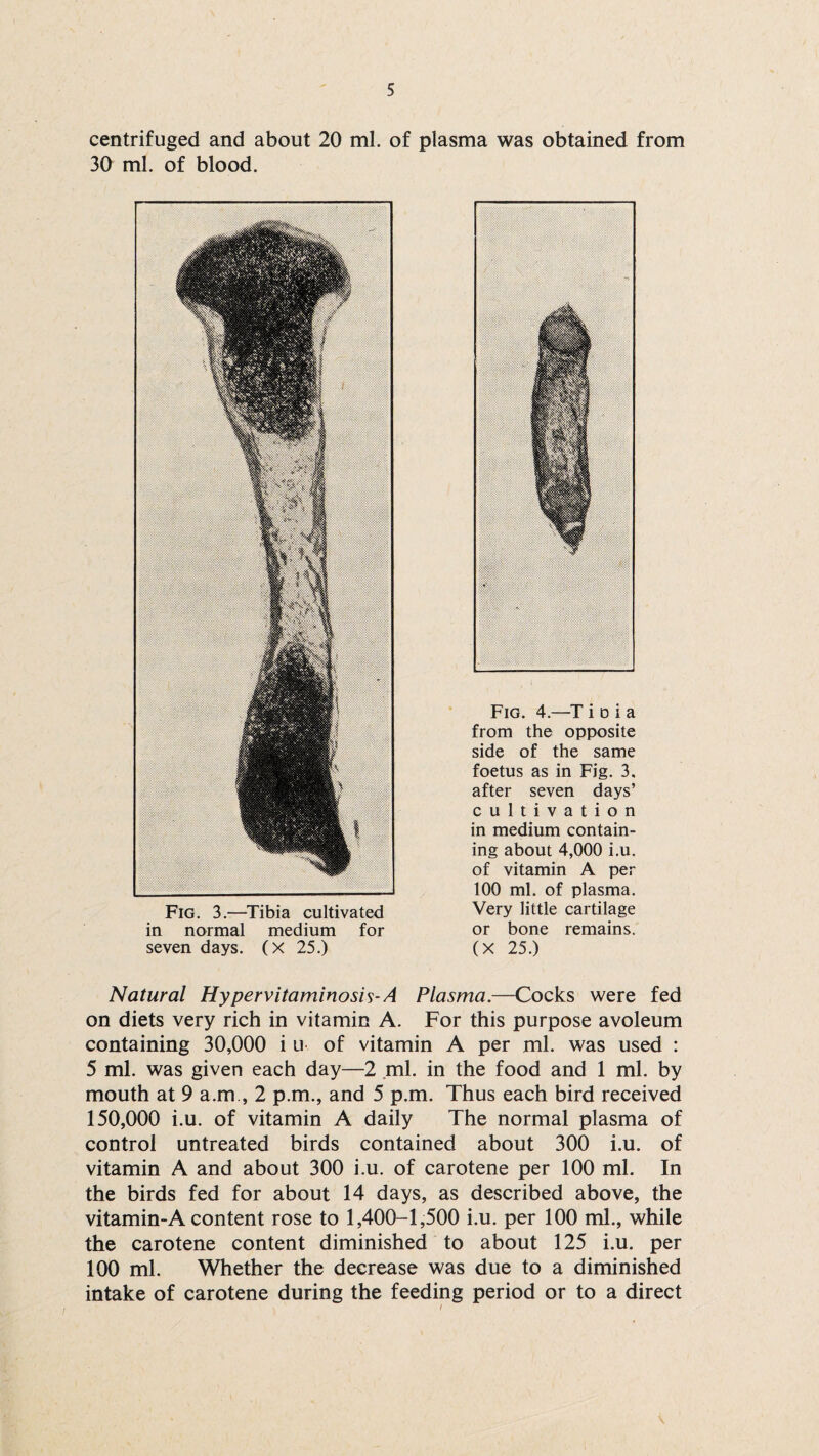 centrifuged and about 20 ml. of plasma was obtained from 30 ml. of blood. Fig. 3.—Tibia cultivated in normal medium for seven days. (X 25.) Fig. 4.—T i d i a from the opposite side of the same foetus as in Fig. 3. after seven days’ cultivation in medium contain¬ ing about 4,000 i.u. of vitamin A per 100 ml. of plasma. Very little cartilage or bone remains. (X 25.) Natural Hypervitaminosis-A Plasma.—Cocks were fed on diets very rich in vitamin A. For this purpose avoleum containing 30,000 i u of vitamin A per ml. was used : 5 ml. was given each day—2 ml. in the food and 1 ml. by mouth at 9 a.m., 2 p.m., and 5 p.m. Thus each bird received 150,000 i.u. of vitamin A daily The normal plasma of control untreated birds contained about 300 i.u. of vitamin A and about 300 i.u. of carotene per 100 ml. In the birds fed for about 14 days, as described above, the vitamin-A content rose to 1,400-1,500 i.u. per 100 ml., while the carotene content diminished to about 125 i.u. per 100 ml. Whether the decrease was due to a diminished intake of carotene during the feeding period or to a direct