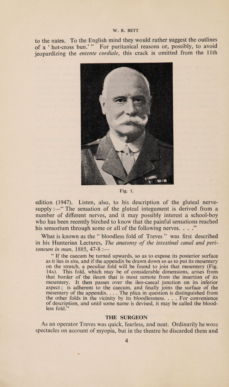 to the nates. To the English mind they would rather suggest the outlines of a ‘ hot-cross bun.’ ” For puritanical reasons or, possibly, to avoid jeopardizing the entente cordiale, this crack is omitted from the 11th Fig. 1. edition (1947). Listen, also, to his description of the gluteal nerve- supply :—“ The sensation of the gluteal integument is derived from a number of different nerves, and it may possibly interest a school-boy who has been recently birched to know that the painful sensations reached his sensorium through some or all of the following nerves. . . .” What is known as the “ bloodless fold of Treves ” was first described in his Hunterian Lectures, The anatomy of the intestinal canal and peri¬ toneum in man, 1885, 47-8 “ If the caecum be turned upwards, so as to expose its posterior surface as it lies in situ, and if the appendix be drawn down so as to put its mesentery on the stretch, a peculiar fold will be found to join that mesentery (Fig. 14a). This fold, which may be of considerable dimensions, arises from that border of the ileum that is most remote from the insertion of its mesentery. It then passes over the ileo-caecal junction on its inferior aspect; is adherent to the caecum, and finally joins the surface of the mesentery of the appendix. . . . The plica in question is distinguished from the other folds in the vicinity by its bloodlessness. . . . For convenience of description, and until some name is devised, it may be called the blood¬ less fold.” THE SURGEON As an operator Treves was quick, fearless, and neat. Ordinarily he wore spectacles on account of myopia, but in the theatre he discarded them and