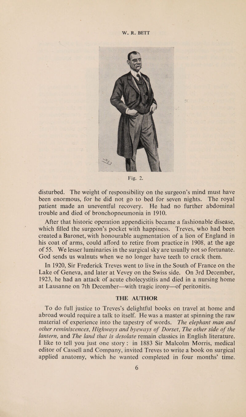 Fig. 2. disturbed. The weight of responsibility on the surgeon’s mind must have been enormous, for he did not go to bed for seven nights. The royal patient made an uneventful recovery. He had no further abdominal trouble and died of bronchopneumonia in 1910. After that historic operation appendicitis became a fashionable disease, which filled the surgeon’s pocket with happiness. Treves, who had been created a Baronet, with honourable augmentation of a lion of England in his coat of arms, could afford to retire from practice in 1908, at the age of 55. We lesser luminaries in the surgical sky are usually not so fortunate. God sends us walnuts when we no longer have teeth to crack them. In 1920, Sir Frederick Treves went to live in the South of France on the Lake of Geneva, and later at Vevey on the Swiss side. On 3rd December, 1923, he had an attack of acute cholecystitis and died in a nursing home at Lausanne on 7th December—with tragic irony—of peritonitis. THE AUTHOR To do full justice to Treves’s delightful books on travel at home and abroad would require a talk to itself. He was a master at spinning the raw material of experience into the tapestry of words. The elephant man and other reminiscences, Highways and byeways of Dorset, The other side of the lantern, and The land that is desolate remain classics in English literature. I like to tell you just one story : in 1883 Sir Malcolm Morris, medical editor of Cassell and Company, invited Treves to write a book on surgical applied anatomy, which he wanted completed in four months’ time.