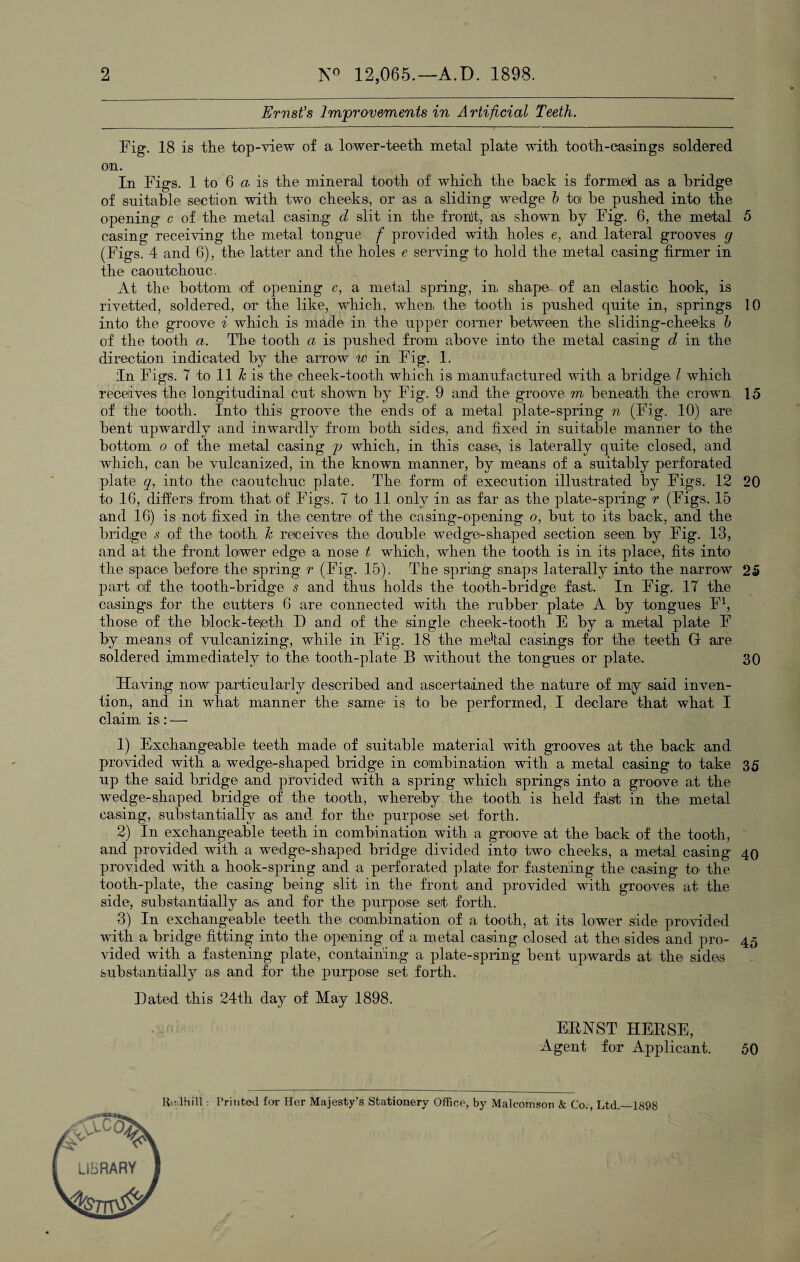 2 N° 12,065.— A. D. 1898. Ernst's Improvements in Artificial Teeth. Fig. 18 is the top-view of a lower-teeth metal plate with tooth-casings soldered on. In Figs. 1 to 6 a is the mineral tooth of which the back is formed as a bridge of suitable section with two cheeks, or as a sliding wedge b toJ be pushed into the opening c of the metal casing d slit in the fronit, as shown by Fig. 6, the metal 5 casing receiving the metal tongue f provided with holes e, and lateral grooves g (Figs. 4 and 6), the latter and the holes e serving to hold the metal casing firmer in the caoutchouc. At the bottom of opening c, a metal spring, in, shape of an elastic hook, is rivetted, soldered, or the like, which, when, the tooth is pushed quite in, springs 10 into the groove i which is made in the upper comer between the sliding-cheeks b of the tooth a. The tooth a is pushed from above into the metal casing d in the direction indicated by the arrow w in Fig. 1. In Figs. 7 to 11 k is the cheek-tooth which is manufactured with a bridge l which receives the longitudinal cut shown by Fig. 9 and the groove m beneath the crown 15 of the tooth. Into this groove the ends of a metal plate-spring n (Fig. 10) are bent upwardly and inwardly from both sides, and fixed in suitable manner to the bottom o of the metal casing y which, in this case, is laterally quite closed, and which, can be vulcanized, in the known manner, by means of a suitably perforated plate q, into the caoutcliuc plate. The form of execution illustrated by Figs. 12 20 to 16, differs from that of Figs. T to 11 only in as far as the plate-spring r (Figs. 15 and 16) is not fixed in the centre of the casing-opening o, but to its back, and the bridge s of the tooth h receives the double wedge-shaped section seen by Fig. 13, and at the front lower edge a nose t which, when the tooth is in its place, fits into the space before the spring r (Fig. 15). The spring snaps laterally into the narrow 25 part of the tooth-bridge s and thus holds the tooth-bridge fast. In Fig. IT the casings for the cutters 6 are connected with the rubber plate A by tongues F1, those of the block-teieth D and of the single cheek-tooth E by a metal plate F by means of vulcanizing, while in Fig. 18 the medal casings for the teeth G are soldered immediately to the tooth-plate B without the tongues or plate. 30 Having now particularly described and ascertained the nature of my said inven¬ tion, and in what manner the same is to be performed, I declare that what I claim is: — 1) Exchangeable teeth made of suitable material with grooves at the back and provided with a, wedge-shaped bridge in combination with a metal casing to take 35 up the said bridge and provided with a spring which springs into a groove at the wedge-shaped bridge of the* tooth, whereby the tooth is held fast in the metal casing, substantially as and for the purpose set forth. 2) In exchangeable teeth in combination with a groove at the back of the tooth, and provided with a wedge-shaped bridge divided into two cheeks, a metal casing 40 provided with a hook-spring and a perforated plate' for fastening the casing k> the tooth-plate, the casing being slit in the front and provided with grooves at the side, substantially as and for the purpose set forth. 3) In exchangeable teeth the combination of a tooth, at its lower side provided with a bridge fitting into the opening of a metal casing closed at thei sides and pro- 45 vided with a fastening plate, containing a plate-spring bent upwards at the sides substantially as and for the purpose set forth. Dated this 24tli day of May 1898. ERAST HERSE, Agent for Applicant. 50 Kuihill: Printed for Her Majesty’s Stationery Office, by Malcomson & Co., Ltd._1898