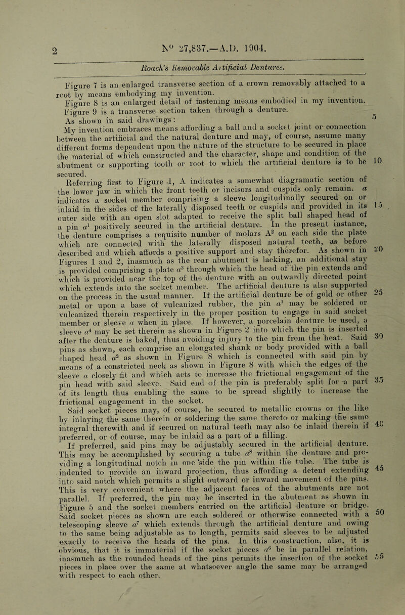 Roach's Removable Artificial Dentures. Figure 7 is an enlarged transverse section of a crown removably attached to a root by means embodying my invention. Figure 8 is an enlarged detail of fastening means embodied m my invention. Figure 9 is a transverse section taken through a denture. As shown in said drawings: . ; My invention embraces means affording a ball and a socket joint or connection between the artificial and the natural denture and may, of course, assume many different forms dependent upon the nature of the structure to be secured m place the material of which constructed and the character, shape and condition of the abutment or supporting tooth or root to which the artificial denture is to be 10 secured. Referring first to Figure -1, A indicates a somewhat diagramatic section of the lower jaw in which the front teeth or incisors and cuspids only remain, a indicates a socket member comprising a sleeve longitudinally secured on or inlaid in the sides of the laterally disposed teeth or cuspids and provided m its lo outer side with an open slot adapted to receive the split ball shaped head of a pin a1 positively secured in the artificial denture. In the present instance, the denture comprises a requisite number of molars A2 on each side the plate which are connected with the laterally disposed natural teeth, as before described and which affords a positive support and stay therefor. As shown m ^0 Figures 1 and 2, inasmuch as the rear abutment is lacking, an additional stay is provided comprising a plate cR through which the head of the pin extends and which is provided near the top of the denture with an outwardly directed point which extends into the socket member. The artificial denture is also supported on the process in the usual manner. If the artificial denture be of gold or other 5 metal or upon a base of vulcanized rubber, the pm (R may be soldered or vulcanized therein respectively in the proper position to engage in said socket member or sleeve a when in place. If however, a porcelain denture be used, a sleeve cR may be set therein as shown in Figure 2 into which the pin is inserted after the denture is baked, thus avoiding injury to the pin from the heat. Said oJ pins as shown, each comprise an elongated shank or body provided with a ball shaped head a2 as shown in Figure 8 which is connected with said pin by means of a constricted neck as shown in Figure 8 with which the edges of the sleeve a closely fit and which acts to increase the frictional engagement of the pin head with said sleeve. Said end of the pin is preferably split for a part of its length thus enabling the same to be spread slightly to increase the frictional engagement in the socket. Said socket pieces may, of course, be secured to metallic crowns or the like by inlaying the same therein or soldering the same thereto or making the same ^ integral therewith and if secured on natural teeth may also be inlaid therein if 4b preferred, or of course, may be inlaid as a part of a filling. If preferred, said pins may be adjustably secured in the artificial denture. This may be accomplished by securing a tube a8 within the denture and pro¬ viding a longitudinal notch in one'side the pin within the tube. The tube is indented to provide an inward projection, thus affording a detent extending 4o into said notch which permits a slight outward or inward movement of the pins. This is very convenient where the adjacent faces of the abutments are not parallel. If preferred, the pin may be inserted in the abutment as shown in Figure 5 and the socket members carried, on the artificial denture or bridge. Said socket pieces as shown are each soldered or otherwise connected with a telescoping sleeve a7 which extends through the artificial denture and owing to the same being adjustable as to length, permits said sleeves to be adjusted exactly to receive the heads of the pins. In this construction, also, it is obvious, that it is immaterial if the socket pieces a6 be in parallel relation, inasmuch as the rounded heads of the pins permits the insertion of the socket pieces in place over the same at whatsoever angle the same may be arranged with respect to each other.