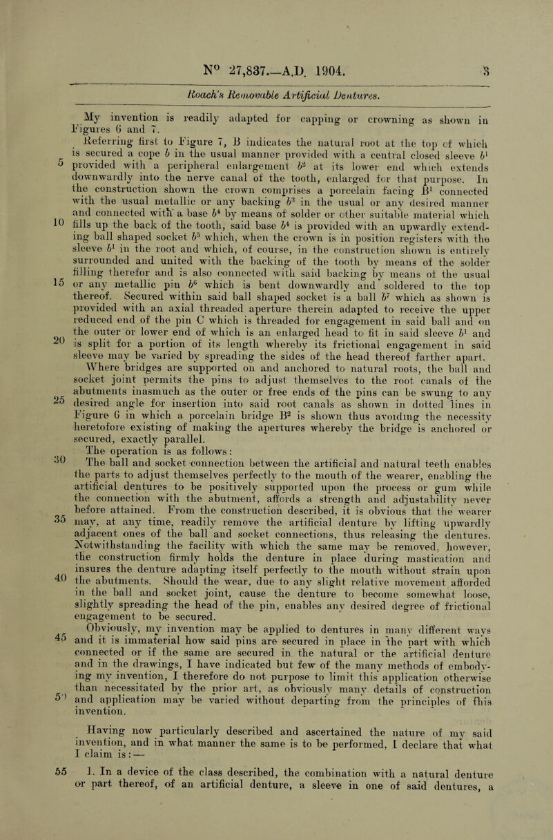 5 10 15 20 25 30 35 40 45 5 > 55 N° 27,837.—A.D. 1904. n O Roach’s Removable Artificial Dentures. My invention is readily adapted for capping or crowning as shown in Figures 0 and 7. deferring first to Tigure 13 indicates tlie natural root at tlie top of winch is secured a cope b in the usual manner provided with a central closed sleeve ¥ provided with a peripheral enlargement b3 at its lower end which extends downwardly into the nerve canal of the tooth, enlarged for that purpose. In the construction shown the crown comprises a porcelain facing B1 connected with the usual metallic or any backing ¥ in the usual or any desired manner and connected with' a base ¥ by means of solder or other suitable material which fills up the back of the tooth, said base ¥ is provided with an upwardly extend¬ ing ball shaped socket ¥ which, when the crown is in position registers with the sleeve ¥ in the root and which, of course, in the construction shown is entirely surrounded and united with the backing of the tooth by means of the solder filling therefor and is also connected with said backing by means of the usual or any metallic pin ¥ which is bent downwardly and soldered to the top thereof. Secured within said ball shaped socket is a ball b‘ which as shown is provided with an axial threaded aperture therein adapted to receive the upper reduced end of the pin C which is threaded for engagement in said ball and on the outer or lower end of which is an enlarged head to fit in said sleeve ¥ and is split for a portion of its length whereby its frictional engagement in said sleeve may be varied by spreading the sides of the head thereof farther apart. Where bridges are supported on and anchored to natural roots, the ball and socket joint permits the pins to adjust themselves to the root canals of the abutments inasmuch as the outer or free ends of the pins can be swung to any desired angle for insertion into said root canals as shown in dotted lines in 1 igure 0 in which a porcelain bridge B3 is shown thus avoiding the necessity heretofore existing of making the apertures whereby the bridge is anchored or secured, exactly parallel. The operation is as follows: The ball and socket connection between the artificial and natural teeth enables the parts to adjust themselves perfectly to the mouth of the wearer, enabling the artificial dentures to be positively supported upon the process or gum while the connection with the abutment, affords a strength and adjustability never before attained. From the construction described, it is obvious that the wearer may, at any time, readily remove the artificial denture by lifting upwardly adjaeent ones of the ball and socket connections, thus releasing the dentures. Notwithstanding the facility with which the same may be removed, however, the construction firmly holds the denture in place during mastication and insures the denture adapting itself perfectly to the mouth without strain upon the abutments. Should the wear, due to any slight relative movement afforded in the ball and socket joint, cause the denture to become somewhat loose, slightly spreading the head of the pin, enables any desired degree of frictional engagement to be secured. Obviously, my invention may be applied to dentures in manv different ways and it is immaterial how said pins are secured in place in the part with which connected or if the same are secured in the natural or the artificial denture and in the drawings, I have indicated but few of the many methods of embody¬ ing mv invention, I therefore do not purpose to limit this application otherwise than necessitated by the prior art, as obviously many details of construction and application may be varied without departing from the principles of this invention. Having now particularly described and ascertained the nature of my said invention, and in what manner the same is to be performed, I declare that what I claim is : — 1. In a device of the class described, the combination with a natural denture or part thereof, of an artificial denture, a sleeve in one of said dentures, a
