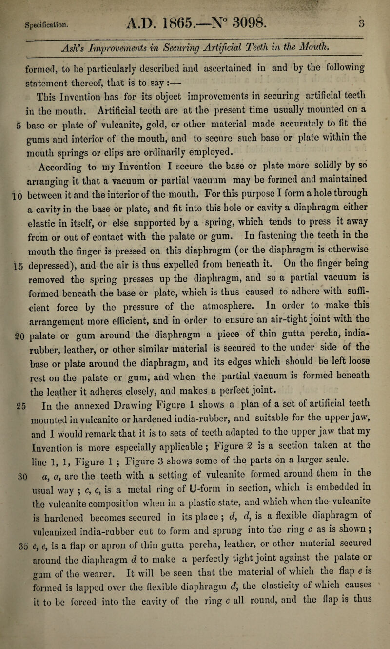 Ash’s Improvements in Securing Artificial Teeth in the Mouth. formed, to be particularly described and ascertained in and by tbe following statement thereof, that is to say :— This Invention has for its object improvements in securing artificial teeth in the mouth. Artificial teeth are at tbe present time usually mounted on a 5 base or plate of vulcanite, gold, or other material made accurately to fit the gums and interior of the mouth, and to secure such base or plate within the mouth springs or clips are ordinarily employed. According to my Invention I secure the base or plate more solidly by so arranging it that a vacuum or partial vacuum may be formed and maintained 1 o between it and the interior of the mouth. For this purpose I form a hole through a cavity in the base or plate, and fit into this hole or cavity a diaphragm either elastic in itself, or else supported by a spring, which tends to press it away from or out of contact with the palate or gum. In fastening the teeth in the mouth the finger is pressed on this diaphragm (or the diaphragm is otherwise 15 depressed), and the air is thus expelled from beneath it. On the finger being removed the spring presses up the diaphragm, and so a partial vacuum is formed beneath the base or plate, which is thus caused to adhere with suffi¬ cient force by the pressure of the atmosphere. In order to make this arrangement more efficient, and in order to ensure an air-tight joint with the 20 palate or gum around the diaphragm a piece of thin gutta percha, india- rubber, leather, or other similar material is secured to the under side of the base or plate around the diaphragm, and its edges which should be left loose rest on the palate or gum, and when the partial vacuum is formed beneath the leather it adheres closely, and makes a perfect joint. 25 In the annexed Drawing Figure 1 shows a plan of a set of artificial teeth mounted in vulcanite or hardened india-rubber, and suitable for the upper jaw, and I would remark that it is to sets of teeth adapted to the upper jaw that my Invention is more especially applicable; Figure 2 is a section taken at the line 1,1, Figure 1 ; Figure 3 shows some of the parts on a larger scale. 30 a, a, are the teeth with a setting of vulcanite formed around them in the usual way ; c, c, is a metal ring of U-form in section, which is embedded in the vulcanite composition when in a plastic state, and which when the-vulcanite is hardened becomes secured in its place ; d, d9 is a flexible diaphragm of vulcanized india-rubber cut to form and sprung into the ring c as is shown; 35 e, e, is a flap or apron of thin gutta percha, leather, or other material secured around the diaphragm d to make a perfectly tight joint against the palate or cum of the wearer. It will be seen that the material of which the flap e is O formed is lapped over the flexible diaphragm d, the elasticity of which causes it to be forced into the cavity of the ring c all round, and the flap is thus