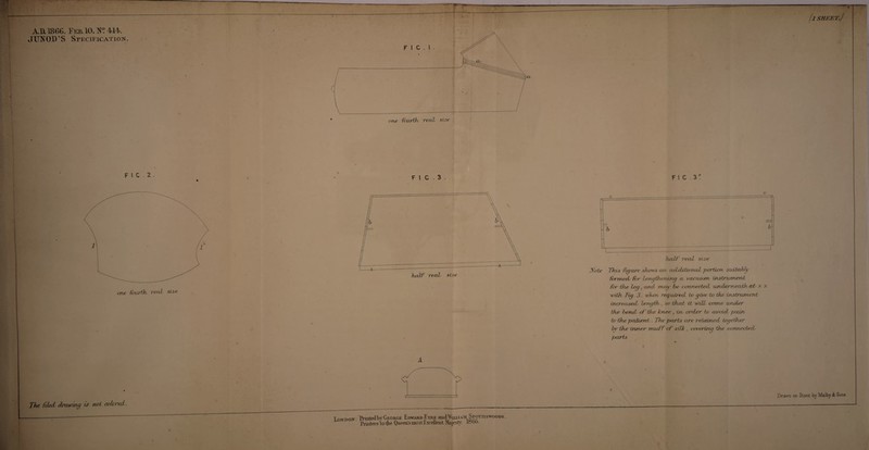 A.D. 1866. EekIO. 411. JTJ^OD'S Specification^. fl SHKET.) The, fijUdi drowui^ F 1 C . 2 . % * (l F 1 C . 3 . is ywt cobored. ONDON Praatedby George Edward Eyre aRdWuxiAii Spottiswoode, Printers to the QiieeRsmoslExcellentiyiajest}' 1866. F 1 C . iKote ITris figrcre sJitnvs art axLcUJixynaZ pcrUrn siuiohly fbrrriedj ivr teru/thenin^ a- vacuMjn iristriarieni, for ihje Leg, and trw^ he connecteci unxierneadh at. x x with. Tig. 3. xvken, regutred. 1x> give to the instnanent tncreasecL length., so thxit it x\ilL come. unxLer the benxL of' the knee , trv order to carotdi pain to the patient . The parts are retained together hr the inner muf f of silk , covering the connected/ parts Prawn on Slone iy MaJby ife Sons