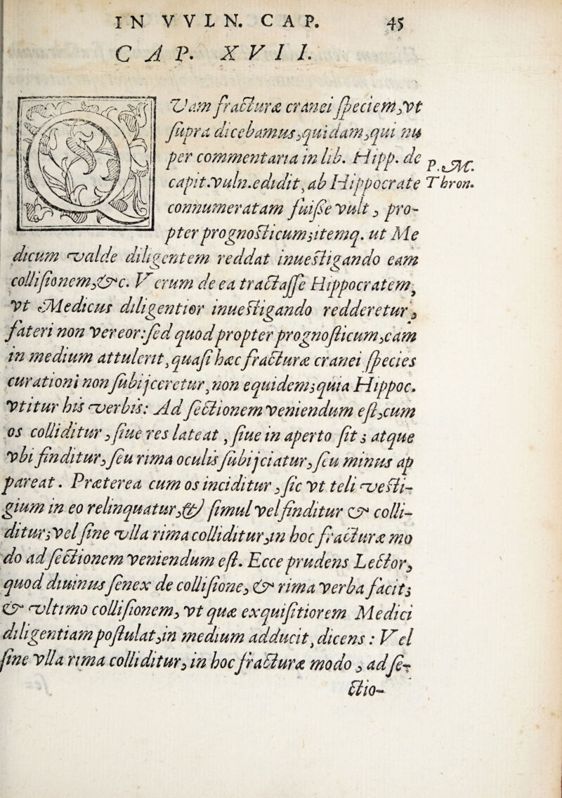 C A p. XVI 1. H .-7 V am frachim cranei fheciem3vt febra, dicebamus 3qui dam3qut m per commentaria in lib. Hipp. de capit:Vuln.edidit, ab Hippocrate connumeratam fuifse vult 3 pro¬ pter prognosticumsitemq. ut Me dicum f-valde diligentem reddat inuesligando eam yt <•Mediem dihgentior wuefh^ando redderetur 3 fateri non Vereorffed quodpropter prognoflicum 3cam in medium attulent, quafi hacfratlurx cranei [pecies curationi nonfebi j ceretur, non equidenaquia Hippoc. Vtitur his njerbis: Adfedhonem veniendum e fecum os colliditur 3 fiue res lateat ,fiue m aperto fit $ atque vbi finditur>feu rima oculisfubijciaturfec u minus ap par eat. Prat ere a cum os incidi tur 3fic vt teli ruefii- gium in eo relinquaturAff fimul velfinditur zs* colli¬ ditur ,Velfine lalla rima colliditur3w hoc fecaoiurx mo do ad fechonem veniendum efe Ecce prudens Lecior3 quod diurnusfenex de colhfione3 & rima Verba facit $ & nvltimo coUifionem3 vt qua, exquifitiorem Medici diligentiampoflulat3in medium adducit, dicens: Vel fine vlla rima colliditur3 m hocfrailura. modo 3 adfe- UlQ~ T hron»