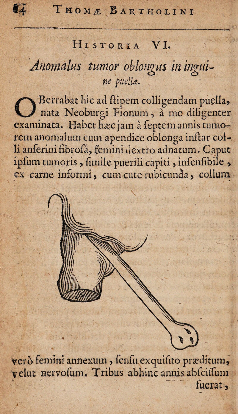 Historia VI. Anomalus tumor oblongus in ingui¬ ne puditi. '■'•'•V: ' ' - , 1 ■ • -' OBerrabat hic ad ftipem colligendam puella* nata Neoburgi Fionum, a me diligenter examinata. Habet ha?c jam a feptem annis tumo¬ rem anomalum cum apendice oblonga inflar col¬ li anferini fibrofa, femini dextro adnatum. Caput ipfum tumoris , fnnile puerili capiti, infenfibile > ex carne informi, cum cute rubicunda> collum vero femini annexum, fenfu exquifito proditum, velut nervofum. Tribus abhinc annis abfcifliim fuerat 3