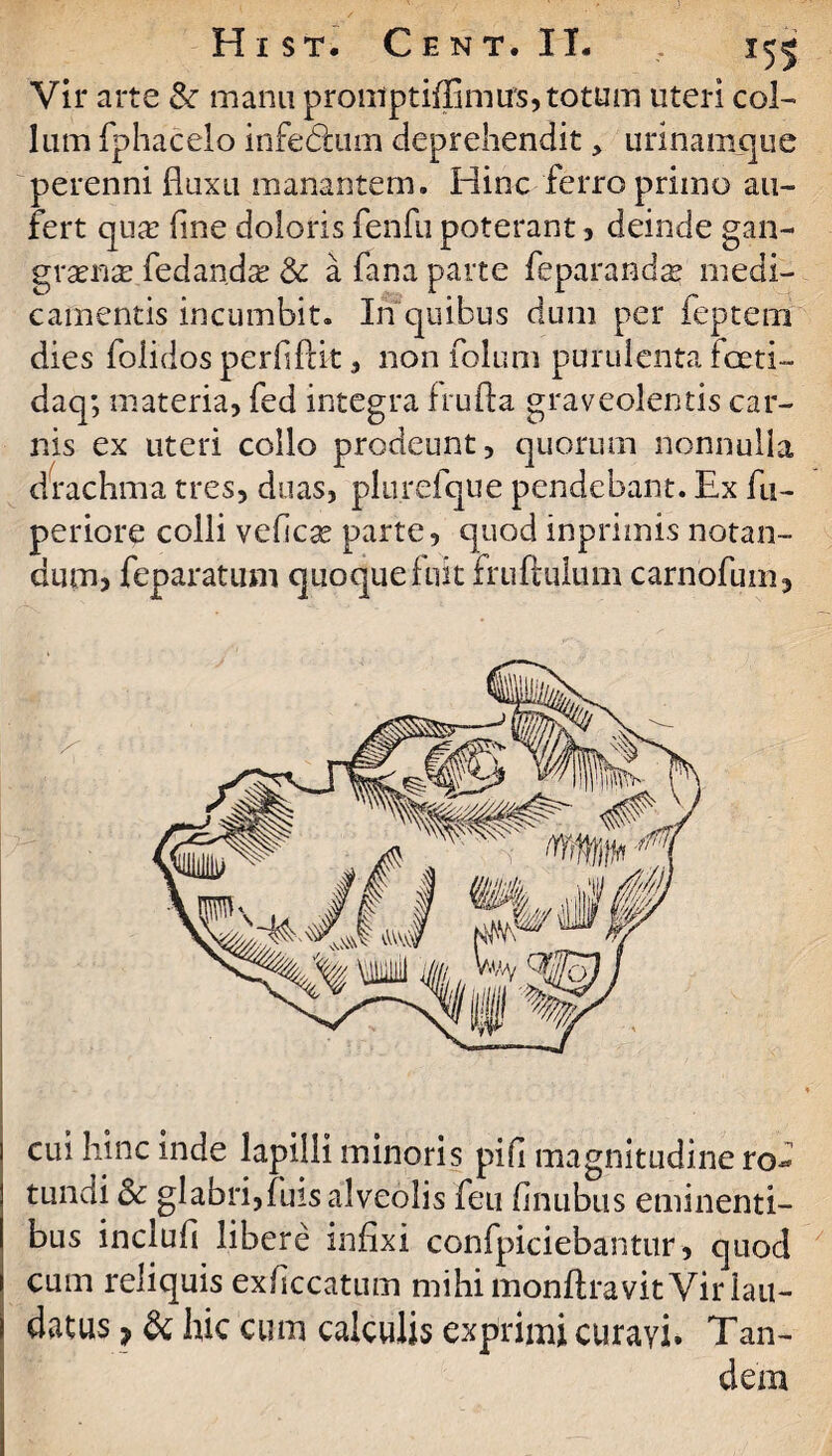 Vir arte & manu proniptiflimus,totum uteri col¬ lum fphacelo infedtum deprehendit, urlnamque perenni fluxu manantem. Hinc ferro primo au¬ fert qua: flne doloris fenfu poterant, deinde gan¬ graena: fedan.dx & a fana parte feparanda? medi¬ camentis incumbit. In quibus dum per feptein dies folidos perflfKt, non folum purulenta foeti- daq; materia, fed integra frufta graveolentis car¬ nis ex uteri collo prodeunt, quorum nonnulla drachma tres, duas, plurefque pendebant. Ex fu- periore colli vefcse parte, quod inprimis notan¬ dum, feparatum quoque fuit fruftulum carnofum. cui hinc inde lapilli minoris pifi magnitudine ro¬ tundi & glabri,fuis alveolis fen finubus eminenti¬ bus inclufi libere infixi confpiciebantur, quod cum reliquis exficcatum mihi monflravit Vir lau¬ datus 7 & hic cum calculis exprimi curavi. Tan¬ dem