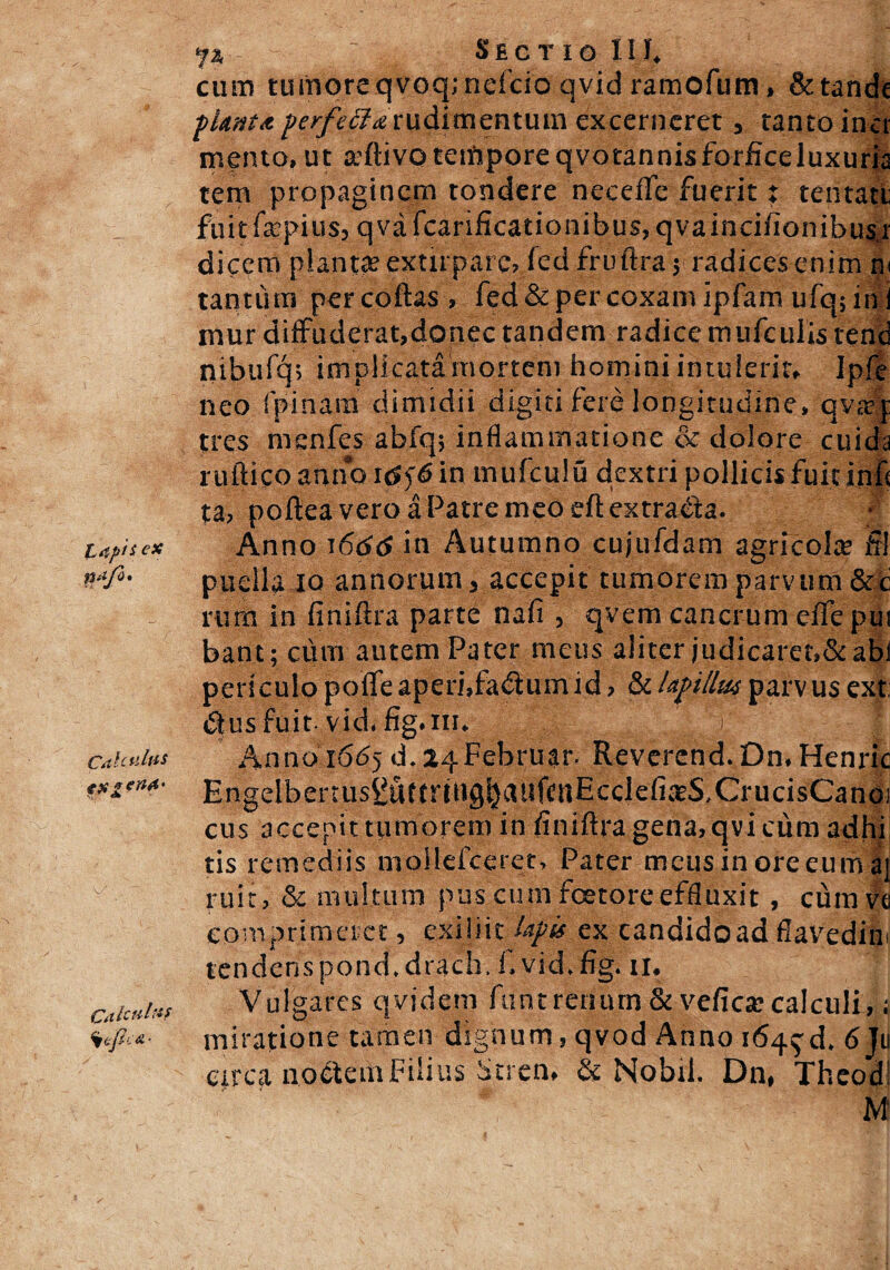 t4pis ex n* Calculas txgen*' Ca halas ■ 1% 7 v„. Sectio I1E cum tumqreqvoq;nefcio qvid ramofum * &tande pUnta perfecta rudimentum excerneret * tanto inei mento, ut activoteiftporeqvotannisforficeluxuna tem propaginem tondere neceffe fuerit : tentatt fuit fapiusj q va fcarificationibus, qvaincifionibusj dicem piante extirpare? fed fruflxa y radices enim n< tantum percoftas, fed & per coxam ipfam ufq;in i mur diffuderat,donec tandem radice mufe illis tend nibufcp implicata mortem homini intulerit* Ipfe neo fpinam dimidii digiti fere longitudine, qvaq: tres menfes abfqj inflammatione & dolore cuidfe ruftico anno 1in mufculu dextri pollicis fuit infc ta, poflea vero a Patre meo eftextraiia. Anno 1666 in Autumno cujufdam agricola? fll puella io annorum * accepit tumorem parvum & c rum in finiflra parte nafi , qvem cancrum eflfepui bant; cum autem Pater meus aliter judicaret,&abi periculopoffeaperi,fadiumid, &Upillutparvusext; iSius fuit- vid- i f Anno 1665 d.24Februar. Revercnd.Dn,Henric Engelbertus2uttniig|)ailfCitEcclefi^S,CrucisCanoi cus accepit tumorem in finiftra gena, qvi cum adhi tis remediis mollefceret, Pater meus in ore eum aj ruit, &c multum pus cum foetoreeffluxit, cum ve comprimeret, exii iit lapis ex candido ad fiavedini tendens pond.drach. f.vidVfig. 11. Vulgares qvidem funt renum & vefica? calculi,; miratione tamen dignum, qvod Anno 164$^ 6 Ju circa noctem Filius Stren* & Nobil, Dn, Theodl M
