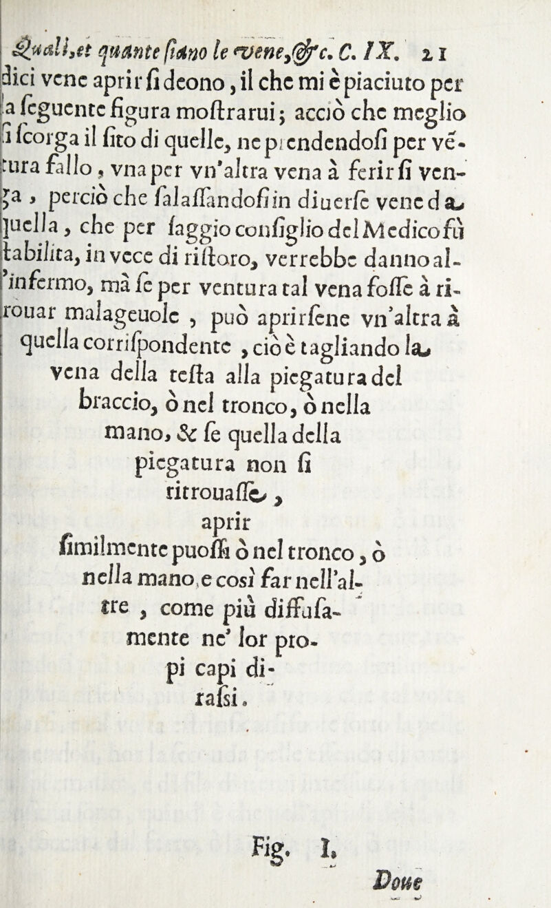 dici vene apri r fi cleono, il che mi è piaciuto per a (cgucntc figura moftrarui ; acciò che meglio fi Icorga il fito di quelle, ne p; cndendofi per ve- tura fallo, vnaper vn’altra vena à ferirli ven- >a » perciò che falafiandofìin diuerfè vene d su l]uclJa, che per faggio configlio del Medicofiì labilità, invece di ri fioro, verrebbe danno ai- in fermo, ma ie per ventura tal vena folle à ri- rouar malageuoic , può aprir lene vn’altraà quella corriIpondentc , cioè tagliando ìsu vena della tefta alla piegatura del braccio, ónci tronco, ònella mano, 3c le quella della piegatura non fi ritrouallc/, aprir fimilmente puoffi ò nel tronco, ò nella mano e cosi farncll’al- A ire , come piu diffufa- mente ne* lor pro¬ pi capi di- ratei, Dotte % h
