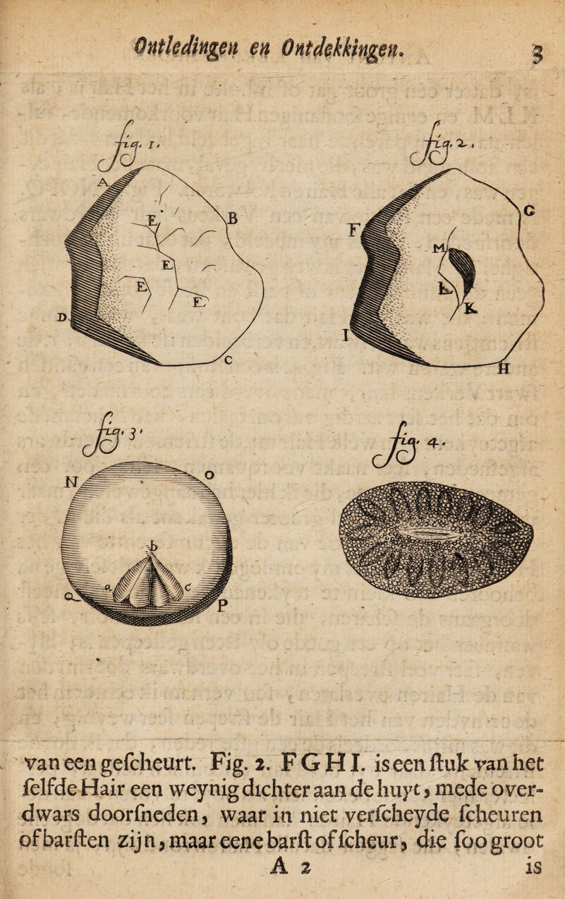 Ontkdimen en Ontdekkingen van een gefcheurt. Fig. 2. F G HI. is een ftuk van het felfde Hair een weynig dichter aan de huy1, mede over¬ dwars doorfneden, waar in niet verfcheyde fcheuren ofbarften zijn,maareenebarftoffcheur, die foogroot