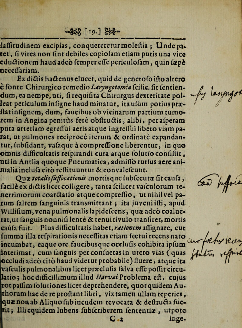 VI «trt fJ&im laffitudinem excipias, conquereretur moleftia 5 Undepa- tet, fi vires non fint debiles copiofam etiam puris una vicc cdudionem haud adeo femper effe periculofam, quin faepi neeeffariam. Ex didis hadenus elucet, quid de generofo ifto altero e fonte Chirurgico remedio Laryngotomia fcilic. fit Tenden¬ dum, ea nempe, uti, firequifita Chirurgus dexteritate pol¬ leat periculum infigne haud minatur, itaufum potius prae- ftatinfignem, dum, faucibusob vicinarum partium tumo¬ rem in Angina penitus fere obftrudis, alibi, perafperam puta arteriam egreffui aeris atque ingreffui libero viam pa¬ rat, ut pulmones reciproce iterum & ordinate expandan¬ tur, lubfidanr, vafaque acompreffione liberentur, in quo omnis difficultatis relpirandi cura atque folutioconfiftit, uti in Antlia quoque Pneumatica, admiffo rurfus aere ani¬ malia inclufa cito reftituuntur &convalefcunt. Qux totalisfuffocatioms mortisque (ubfecutse fitcaufa, facile ex dsdis licet colligere, tanta fcilicet vafculorum te¬ nerrimorum coardatio atque compreffio, ut nihil vel pa¬ rum faltem fanguinis transmittant $ ita juveni ifti, apud Willifium, vena pulmonalis lapidefcens, quae adeo coalue¬ rat,ut fanguis nonmfi lente & tenui rivulo tranfiret, mortis caufa fuit. Plus difficultatis habet, rationem affignare, cur fumma illa refpirationis neceflitas etiam foetui recens nato incumbat, eaqueore faucibusqueocclufis cohibita ipfum interimat, cum fanguis perconfuetasin utero vias (quas occludi adeo cito haud videtur probabile) fluere, atque ita vafculis pulmonalibus licet praeclufis falva effe poffit circu¬ latio; hocdifficillimum illud HarvaiProblema eft, cujus totpaffim folutiones licet deprehendere, quot quidem Au- thorum hac de re proflant libri, vix tamen ullam reperies, quaenonab Aliquofubincudem revocata & deftrudafue¬ rit; Illi equidem lubens fubfcriberem fententiae, utpotc C «2 inge- M, fi Ityyr*