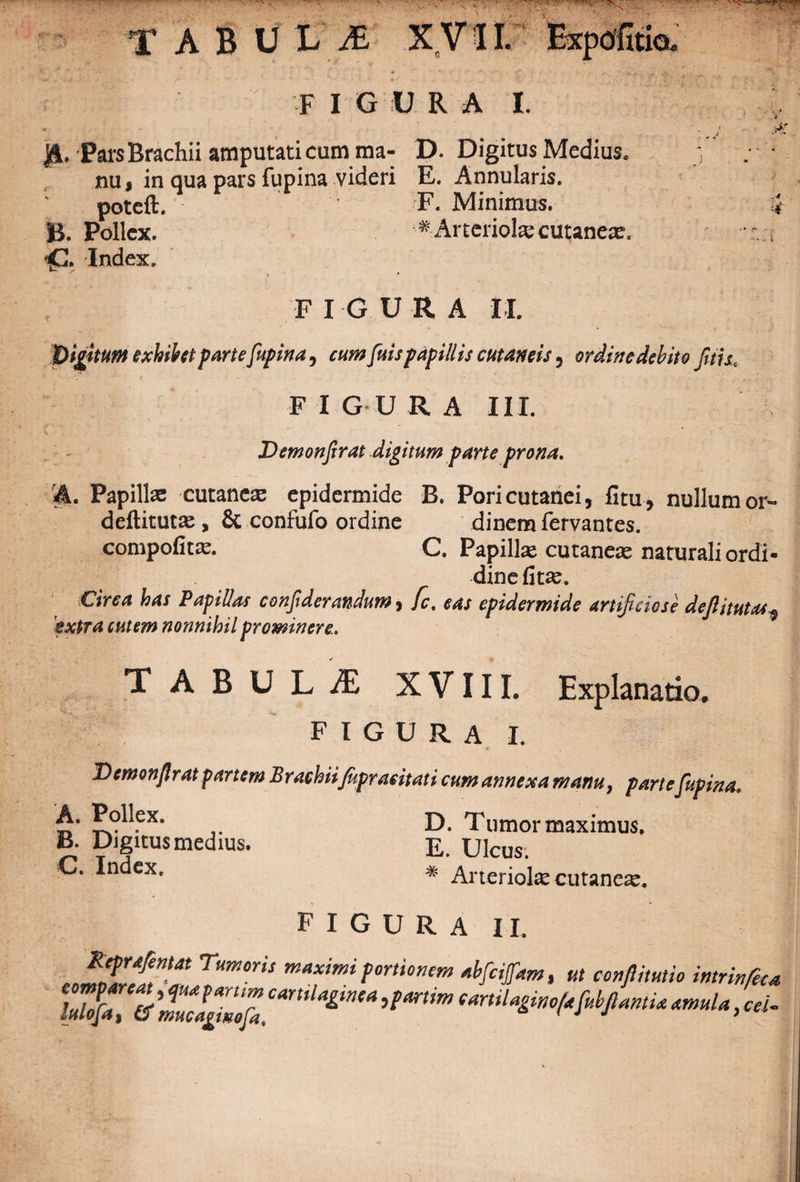 « *> . './■ t£ f!.. 'i* .J. F IGUR A I. A» Pars Brachii amputati cum ma- D. Digitus Medius, nu % in qua pars fupina videri E. Annularis, poteft. F. Minimus. B. Pollex. ^Arteriolae cutaneae. *£!. Index. FIGURA I I. 'Digitum exhibet parte fupina, cum fuis papillis cutaneis , ordine debito Jitu. FIGURA III. Demonfirat digitum parte prona. A. Papillae cutanese epidermide B. Pori cutanei, litu , nullum or- deftitutse, &amp; confufo ordine dinera fervantes. compofitae. C. Papillae cutaneae naturali ordi- dine litae. Circa has Papillas confderandum, fc, eas epidermide artificiose dejlitutas $ extra cutem nonnihil prominere.. Explanatio. TABULiE XVIII. figura i. Demonjlrat partem Brachiifapracitati cum annexa manu, parte fupina. D. Tumor maximus. A. Pollex. B. Digitus medius. C. Index. E. Ulcus. * Arteriolae cutaneae. FIGURA II. elZfT-f Tum°ris max’m* portionem abfcijfam, ut conflitutio intrinfeca mTcIfllf cmtlatin'« ^tilaginofafubfiamia amula, cei-