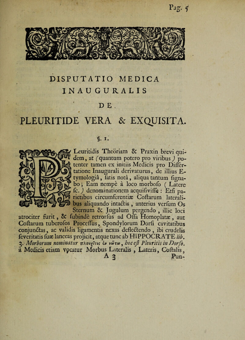 Pag-- f DISPUTATIO MEDICA INAUGURALIS D E . ♦ s PLEURITIDE VERA & EXQUISITA. §. i. 'T ‘ / Leuritidis Theoriam Sc Praxin brevi qui¬ dem , at (quantum potero pro viribus) po¬ tenter tamen ex initiis Medicis pro Diller- tatione Inaugurali derivaturus, de illius E- tymologia, fatis nota, aliqua tantum figna- bo; Eam nempe a loco morbofo ( Latere Ic.) denominationem acquifiville : Etli pa¬ rietibus circumferentiae Collarum laterali¬ bus aliquando intadlis , anterius verfum Os Sternum £c Jugulum pergendo , illic loci atrociter furit, Sc fubinde retrorfus ad Olla Homoplatae , aut Collarum tuberofos ProcelTus, Spondylorum Dorii cavitatibus conjundtas, ac validis ligamentis nexas defledtendo , ibi crudelis feveritatis fuae lanceas projicit, atque tunc ab HIPPOCRATE lib. 3.Morborum nominatur TrAsv^rn? i» vwtw, hocefi Pleuritis in Dorfo. a Medicis etiam vpcatur Morbus Lateralis , Lateris, Collalis3 A 2 Pun» \