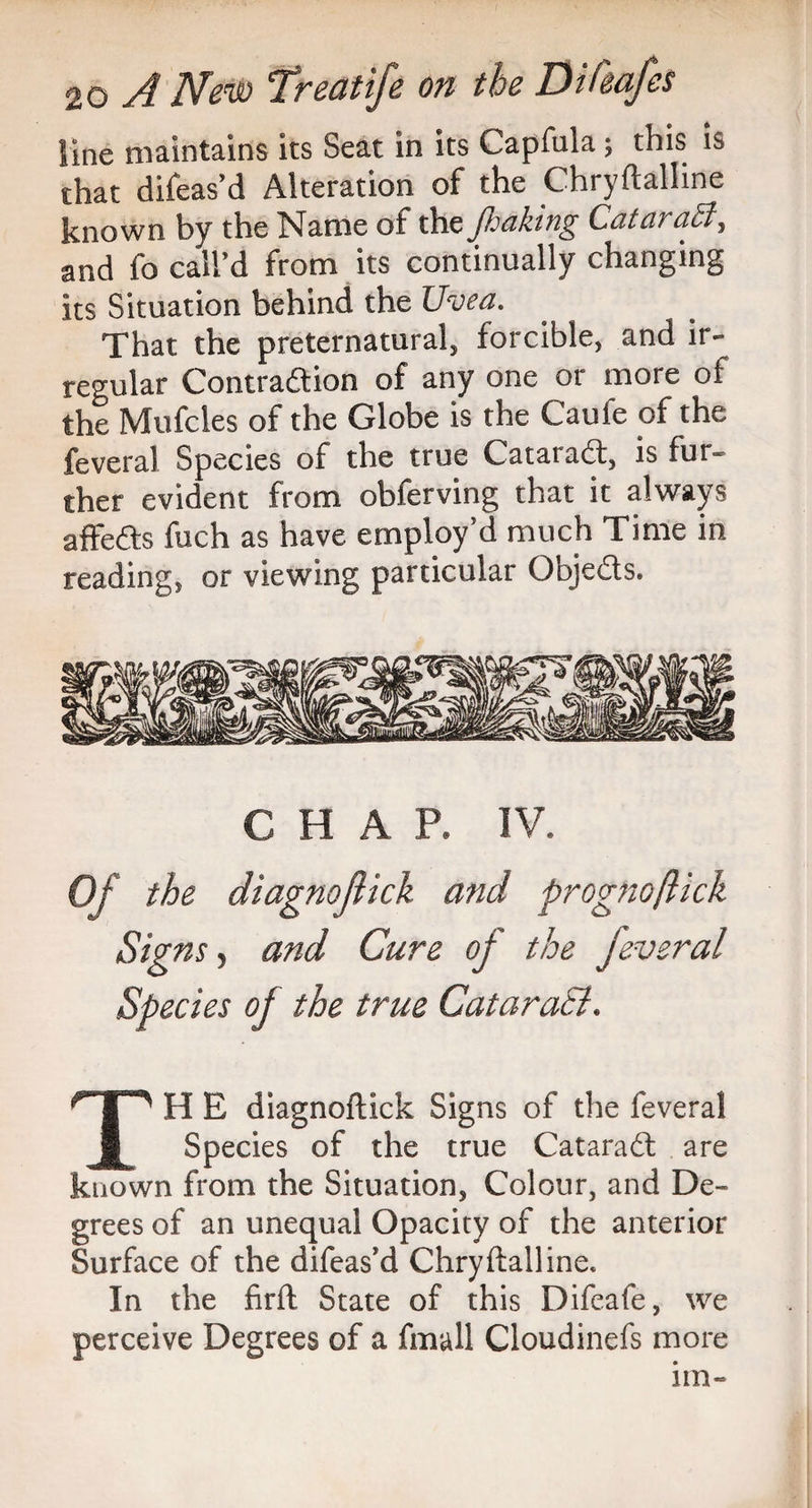 Sine maintains its Seat in its Capfula; this is that difeas’d Alteration of the Chryftalline known by the Name of the /baking Qatar aft, and fo call’d from its continually changing its Situation behind the Uvea. That the preternatural, forcible, and ir¬ regular Contraction of any one oi more of the Mufcles of the Globe is the Caufe of the feveral Species of the true CataraCt, is fur¬ ther evident from obferving that it always affeCts fuch as have employ’d much Time in reading, or viewing particular ObjeCts. CHAP. IV. Of the diagnojlick and prognoftick Sig ns, and Cure of the jeveral Species oj the true Cataract. TH E diagnoftick Signs of the fevera! Species of the true Cataradf are known from the Situation, Colour, and De¬ grees of an unequal Opacity of the anterior Surface of the difeas’d Chryftalline. In the firft State of this Difeafe, we perceive Degrees of a fmall Cloudinefs more im-