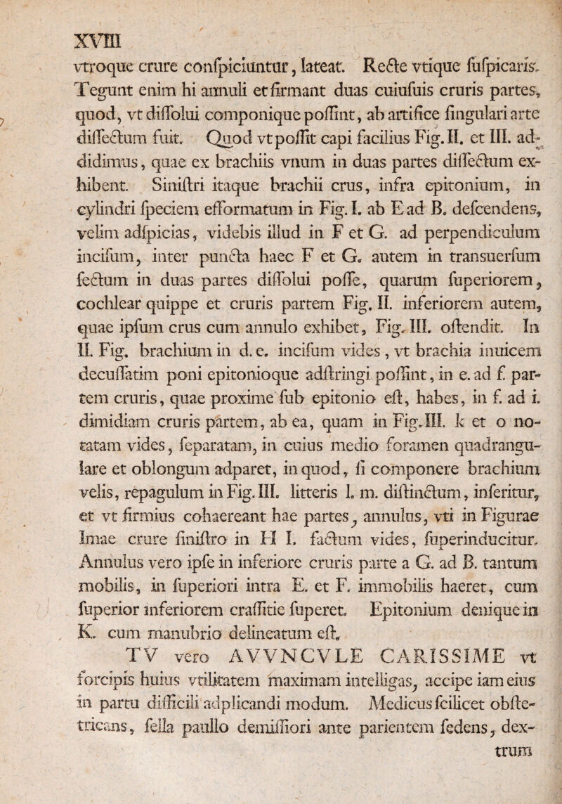 XVffl ; ' ■ vtroque crure confpiciuntar, lateat Refte vtique fufpicaris; Tegunt enim hi annuli et firmant duas cuiufuis cruris partes, quod, vt difTolui componique poffint, ab artifice fingulari arte diffeffum fuit Quod vtpoffit capi facilius Fig.II. et HI. ad¬ didimus , quae ex brachiis vnum in duas partes diffeffum ex¬ hibent. Siniftri itaque brachii crus, infra epitonium, in cylindri fpeciem efformatum in Fig. I. ab E ad B. defcendens, velim adfpicias, videbis illud in F et G. ad perpendiculum incifum, inter pun&a haec F et G. autem in transuerfum feffum in duas partes difTolui poffe, quarum fuperiorem, cochlear quippe et cruris partem Fig. II. inferiorem autem, quae ipfum crus cum annulo exhibet, Fig. III. offendit. In II. Fig. brachium in d. e. incifum vides, vt brachia inuicem decuffatim poni epitonioque adflringi poffint, in e. ad £ par¬ tem cruris, quae proxime fub epitonio eff, habes, in f. ad i. dimidiam cruris partem, ab ea, quam in Fig.III. k et o no¬ tatam vides, feparatam, in cuius medio foramen quadrangu¬ lare et oblongum adparet, in quod, fi componere brachium velis, repagulum in Fig. III. litteris 1. m. diffindlum, inferitur, et vt firmius cohaereant hae partesannulus, vti in Figurae Imae crure finiftro in FI I. fadfuni vides, fuperinducitur, Annulus vero ipfe in inferiore cruris parte a G. ad B. tantum mobilis, in fuperiori intra E. et F. immobilis haeret, cum ? j . fuperior inferiorem craffitie fuperet. Epitonium denique in , K. cum manubrio delinearam eff. TV vero AVVNCVLE CARISSIME vt forcipis huius vtilitatem maximam intelligas, accipe iam eius in partu difficili adplicandi modum. Medicusfcilicet obffe- tricans, fella paullo demiffiori ante parientem fedens, dex¬ trum