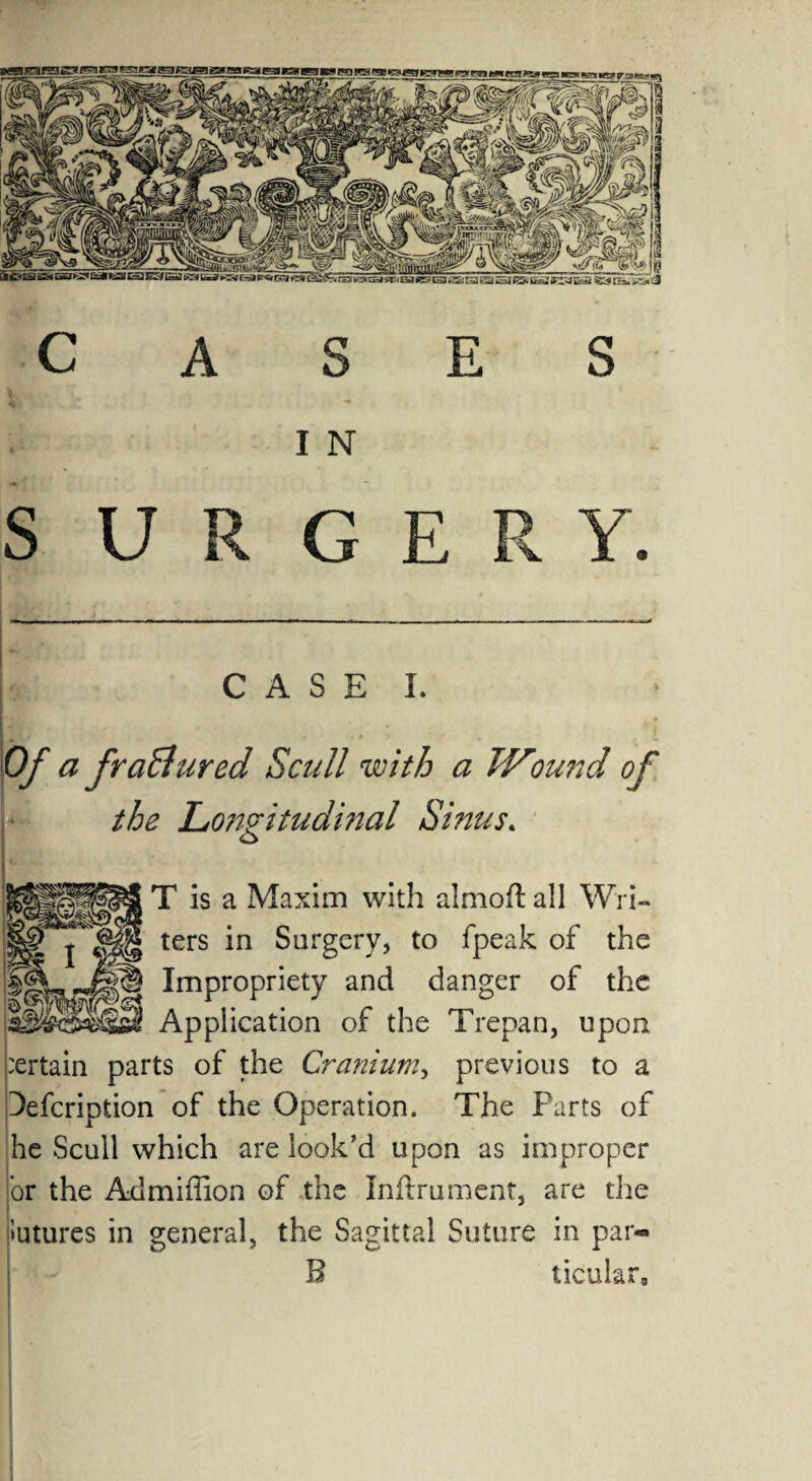 I N SURGERY. CASE I. Of a fraSlured Scull with a Wound of the Longitudinal Sinus. o 5te T is a Maxim with almofl all Wri- ters in Surgery, to fpeak of the HkJS Impropriety and danger of the Application of the Trepan, upon certain parts of the Cranium, previous to a Defcription of the Operation. The Parts of he Scull which are look’d upon as improper or the Admiffion of the Inftrument, are the futures in general, the Sagittal Suture in par- B ticular8