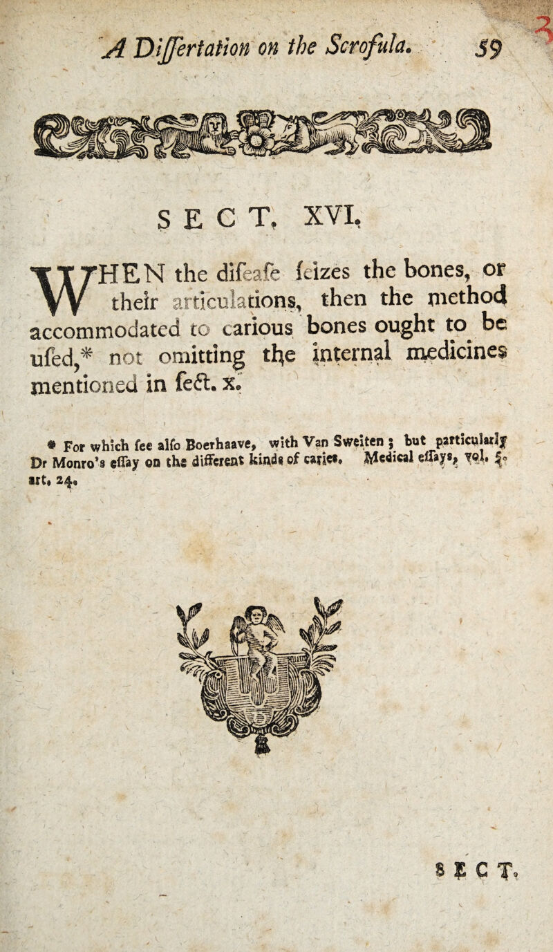 V SECT, XVI, WHEN the difeafe feizes the bones, or their articuladons, then the niethod accommodated to carious bones ought to^ be ufed,* not omitting the internd medicines mentioned in feft. x, * For which fee alfo Boethaave, with Van Sweiten ; hut patticulatlj Dr Monro’s effay on the different kinds of catiea, J^edical effaya^ yel. iiti 24. 8 ¥ C T.