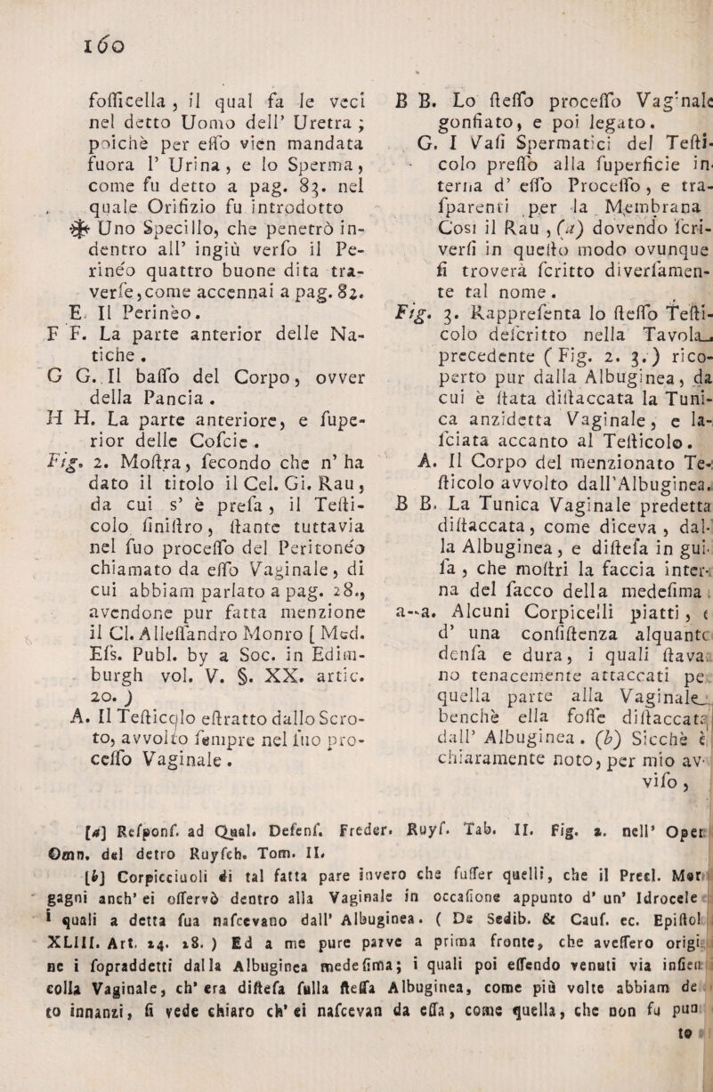 i6o folli cella , il qual fa le veci ne! detto Uomo dell’ Uretra ; poiché per elfo vicn mandata fuora P Urina, e Io Sperma, come fu detto a pag. 83. nel quale Orifìzio fu introdotto tj* Uno Specillo, che penetrò in¬ dentro all’ ingiù verfo il Pe¬ rineo quattro buone dita tra¬ vede, come accennai a pag. 82. E* Il Perinèo. F F. La parte anterior delle Na¬ tiche . G G. Il baffo del Corpo, ovver della Pancia . H H. La parte anteriore, e fupe- rior delle Cofcic . Fig* 2. Mod.ra, fecondo che n’ha dato il titolo il Gel. Gi. Rau 5 da cui s’ è prefa , il Tedi- colo Anidro, dante tuttavia nel fuo proceffo del Peritoneo chiamato da elfo Vaginale, di cui abbiam parlato a pag. 28.5 avendone pur fatta menzione il CI. Àlledandro Monto [ Med. Efs. Pubi, by a Soc. in Edim- burgh voi. V. §. XX. artic. 2°. ) A. II Tedicelo edratto dallo Scro¬ to, avvolto Amipre nel ino pro¬ cedo Vaginale. B B. Lo delfo proceffo Vag!nak gonfiato, e poi legato. G. I Vali Spermatici del Tedi- colo predo alla fuperficie in< terna d7 elfo Procedo , e tra- fparenti per la Membrana Cosi il Rau , (a) dovendo fcri- verfi in quello, modo ovunque fi troverà fcritto diverfamen- te tal nome. Ftg* 3. Rapprefenta lo dedo Tedi- colo deferìtto nella Tavola-, precedente ( Fig. 2. 3.) rico¬ perto pur dalla Albuginea, da cui è data didaccata la Tuni¬ ca anzidetta Vaginale, e la-, fciata accanto al Tedieoi©. A. Il Corpo del menzionato Te-: dicolo avvolto dalPAlbuginea. B R* La Tunica Vaginale predetta didaccata, come diceva, dal¬ la Albuginea, e didefa in gui- ia , che modri la faccia inter-, na del facco della medefima a—a. Alcuni Corpicelli piatti, t d* una confidenza alquante denfa e dura, i quali dava no tenacemente attaccati pe quella parte alla Vaginale, benché ella foffe didaccata da 1P Albuginea. (b) Sicché èi chiaramente noto, per mio av¬ vilo , [a] Rcfponf. ad Qual. Defenf. Freder. Ruyf. Tab. II. Fig, *. nell’ Opet ©mn. del detro Ruyfeh. Tom. II. |>] Corpicciuoii di tal fatta pare invero che fiifTer quelli, che il Pred. M«r ' gagni anch’ ei offervò dentro alla Vaginale in occafione appunto d* un* Idrocele * quali a detta fua nafeevano dall’ Albuginea. ( Ds Sedib. & Cauf. ec. Epiftol XLIII. Art. 14. iB. ) Ed a me pure parve a prima fronte, che avellerò origi uc i fopraddetti dalla Albuginea medefima; i quali poi effendo venati via infien colla Vaginale, eh* era diftefa falla ftefifa Albuginea, come più volte abbiadi de to innanzi, fi vede chiaro eh* ei nafeevan da ella, come quella, che non fu Paa te
