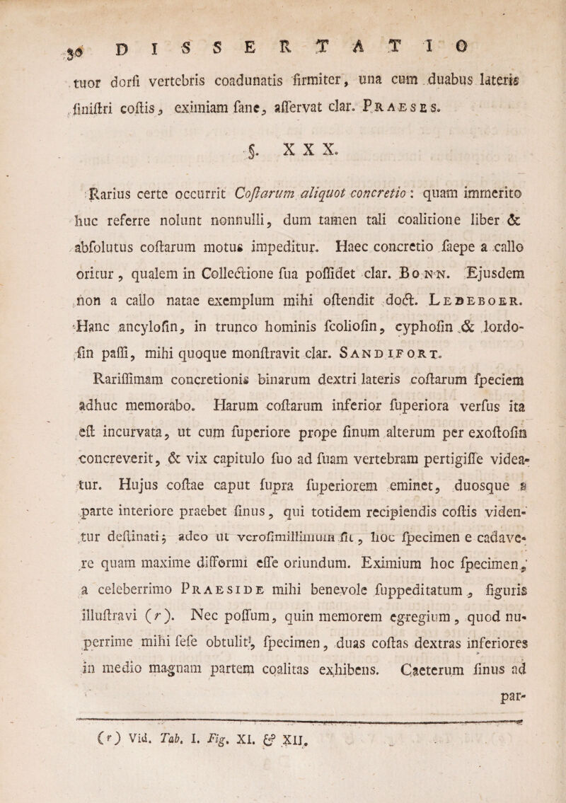 s.9 DISSERTA t i g tuor dorfi vertebris coadunatis firmiter, una cum duabus lateris finiftn' coftis, eximiam fane, aflervat clar. Praeses. §. XXX. Rarius certe occurrit Coflarum aliquot concretio : quam immerito huc referre nolunt nonnulli, dum tamen tali coalirione liber & abfolutus coflarum motus impeditur. Haec concretio faepe a callo oritur, qualem in Collectione fua poffidet clar. Bonn. Ejusdem ,non a callo natae exemplum mihi oflendit do<5t. Lebeboer. ^Hanc ancylofm, in trunco hominis fcoliofin, cyphofin iordo* fin paffi, mihi quoque monflravit clar. SandiforTo Rariffimam concretionis binarum dextri lateris coflarum fpeciem adhuc memorabo. Harum coflarum inferior fuperiora verfus ita efl incurvata, ut cum fuperiore prope finum alterum per exoftofm concreverit, & vix capitulo fuo ad fuam vertebram pertigiffe videa» tur. Hujus coflae caput fupra fuperiorem eminet, duosque % parte interiore praebet finus, qui totidem recipiendis coflis viden¬ tur deflinati$ adeo ut vcroflmilliiiiLiin ili, lioc fpecimen e cadave* re quam maxime difformi effe oriundum. Eximium hoc fpecimen, a celeberrimo Praeside mihi benevole fuppeditatum , figuris Illuftravi (r). Nec poffum, quin memorem egregium, quod nu¬ perrime mihi fefe obtulit5, fpecimen, duas coftas dextras inferiores , > in medio magnam partem cqalitas exhibens. Caeterum finus ad par-