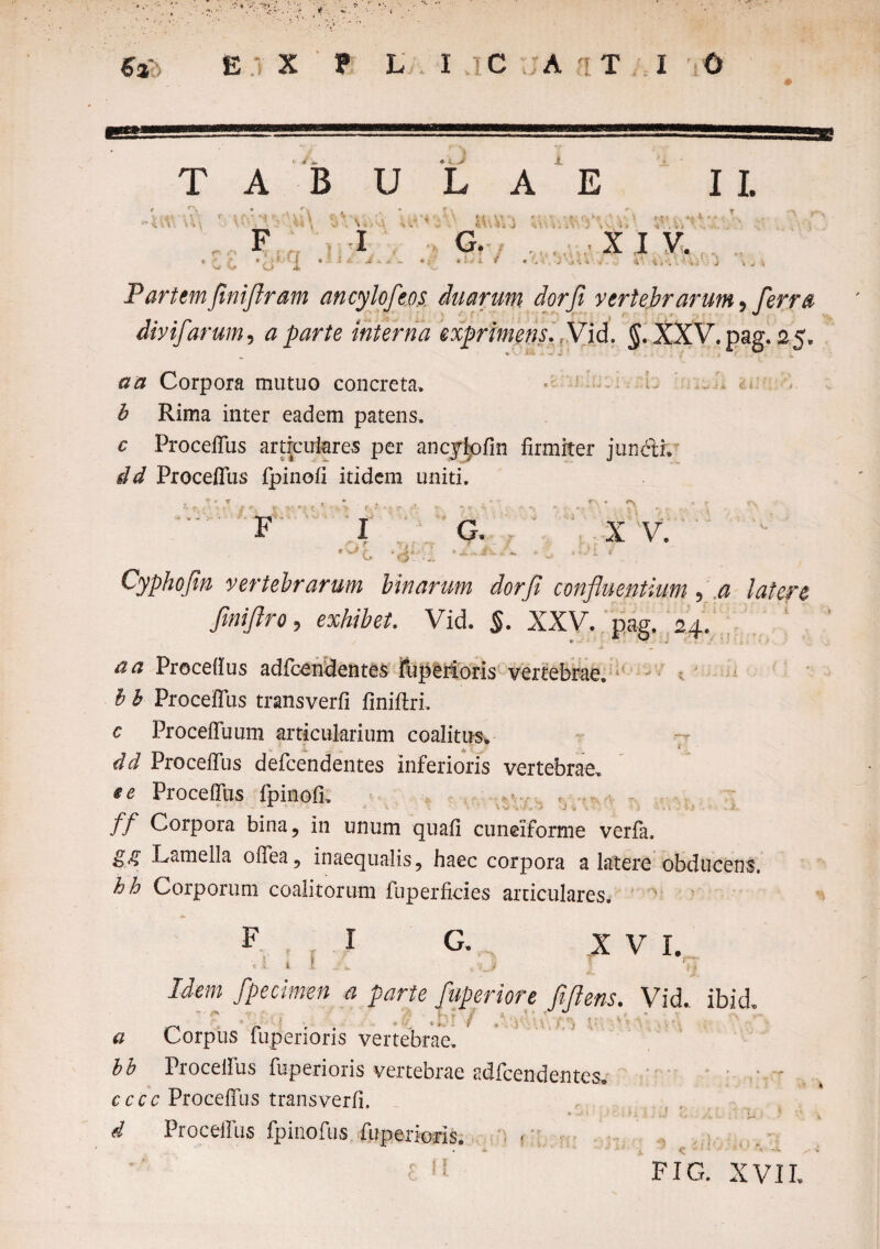 4 ~ TABULAE I I. ,\\ C; 4 t ° , { f- . i ! ^ v O q i G. «* % . * -i J 'i > . i i i, * X I V. Partem fmiflram ancylofeos duarum dorfi vertebrarum, ferra divi/arum, a parte interna exprimens. fVid. $. XXV.pag. 25, an Corpora mutuo concreta. * ... . . , : b Rima inter eadem patens. c ProcefTus articulares per ancylpfin firmiter juncli. dd ProcefTus fpinofi itidem uniti. F X V. Cyphojin vertebrarum binarum dorfi confluentium, a latere , exhibet. Vid. §. XXV. it- aa Procefius adfcendentes jfbperioris vertebrae. b b ProcefTus transverfi finiftri. c Procefluum articularium coalitus* s * JL it T * dd ProcefTus defcendentes inferioris vertebrae. e e ProcefTus fpinofi. ff Corpora bina? in unum quafi cuneiforme verfa. gg Lamella offea? inaequalis 9 haec corpora a latere obducens. hh Corporum coalitorum fuperficies articulares. F I G. XVI. . I 1 ! . Idem fpecimm a parte fuperiore fidens. Vid. ibid. a Corpus fuperioris vertebrae. bb Procelfus fuperioris vertebrae adfcendentes* ■ • - cccc ProcefTus transverfi. , • . f «, d Proceffus fpinofus fuperioris. i 1 FIG. XVII.