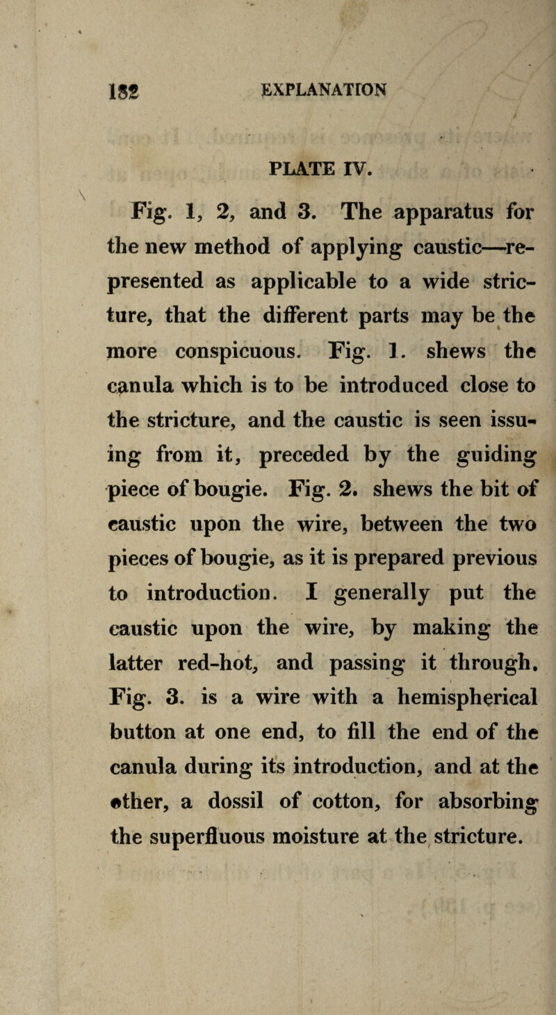 PLATE IV. Fig. 1, 2, and 3. The apparatus far the new method of applying caustic—re¬ presented as applicable to a wide stric¬ ture, that the different parts may be the more conspicuous. Fig. 1. shews the canula which is to be introduced close to the stricture, and the caustic is seen issu¬ ing from it, preceded by the guiding piece of bougie. Fig. 2. shews the bit of caustic upon the wire, between the two pieces of bougie, as it is prepared previous to introduction. I generally put the caustic upon the wire, by making the latter red-hot, and passing it through. Fig. 3. is a wire with a hemispherical button at one end, to fill the end of the canula during its introduction, and at the ether, a dossil of cotton, for absorbing the superfluous moisture at the, stricture.