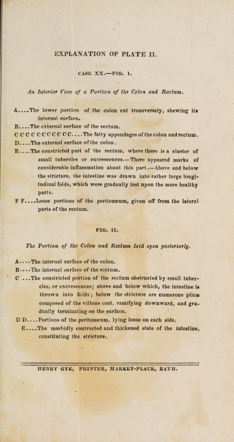 CASE XX.—FIG. I. An Interior View of a Portion of the Colon and Rectum. A. ...The lower portion of the colon cut transversely, shewing its internal surface. B. .. .The external surface of the rectum. CCCC CCCCCCC... .The fatty appendages of the colon and rectum. D. .. .The external surface of the colon. E. . ..The constricted part of the rectum, where there is a cluster of small tubercles or excrescences.—There appeared marks of considerable inflammation about this part.—Above and below the stricture, the intestine was drawn into rather large longi¬ tudinal folds, which were gradually lost upon the more healthy parts. FF....Loose portions of the peritonaeum, given off from the lateral parts of the rectum. FIG. II. The Portion of the Colon and Rectum laid open posteriorly, A• • • • The internal surface of the colon. B > • • *The internal surface of the rectum. C ...The constricted portion of the rectum obstructed by small tuber¬ cles, or excrescences; above and below which, the intestine i» thrown into folds; below the stricture ars numerous plicae composed of the villous coat, ramifying downward, and gra¬ dually terminating on the surface. D D.. ..Portions of the peritonaeum, lying loose on each side. E....The morbidly contracted and thickened state of the intestine, constituting the stricture. HENRY GYE, PRINTER, MARKET-PLACE, BATH.